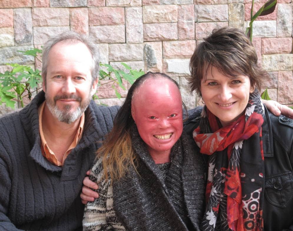 Rog and Tina Thomas pose for a picture with their daughter, Mui, whom they adopted 30 years ago, in a Facebook post from 2015. Mui was born with Harlequin ichthyosis, a rare and often fatal genetic disorder. Rog and Tina now share their story in their new book, An Unexpected Adoption: The Girl Behind The Face.