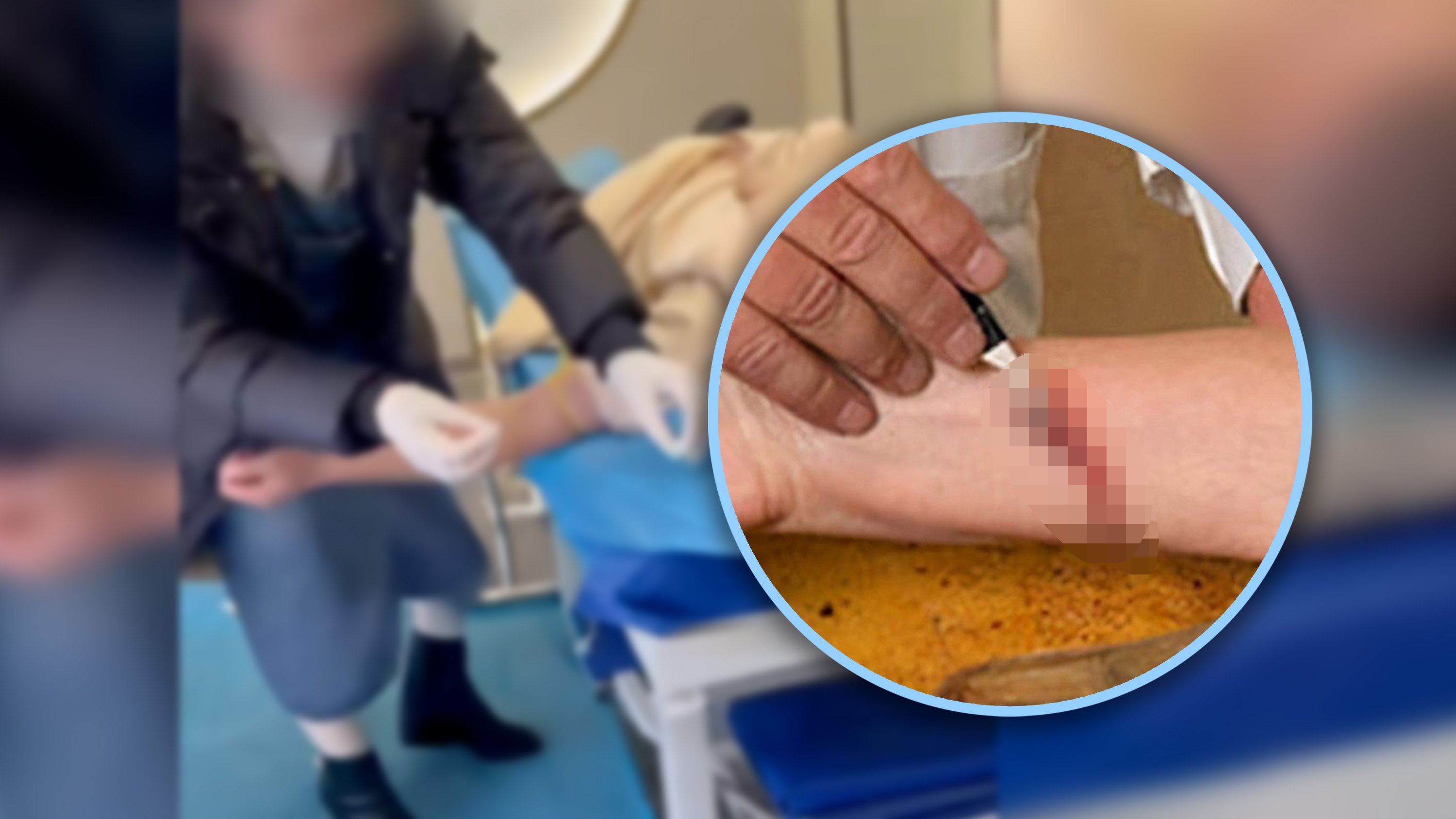 The Chinese authorities have cracked down on self-proclaimed doctors who have been performing “bloodletting therapy”, claiming it can remove evil energy. Photo: SCMP composite/Weibo/Zhihu