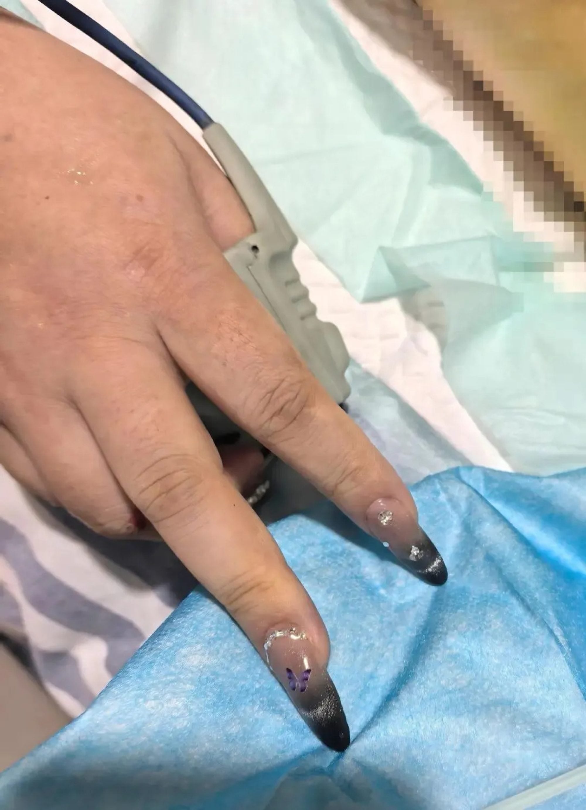 Lili’s fake nails, above, presented a dangerous impediment to her emergency treatment. Photo: Handout