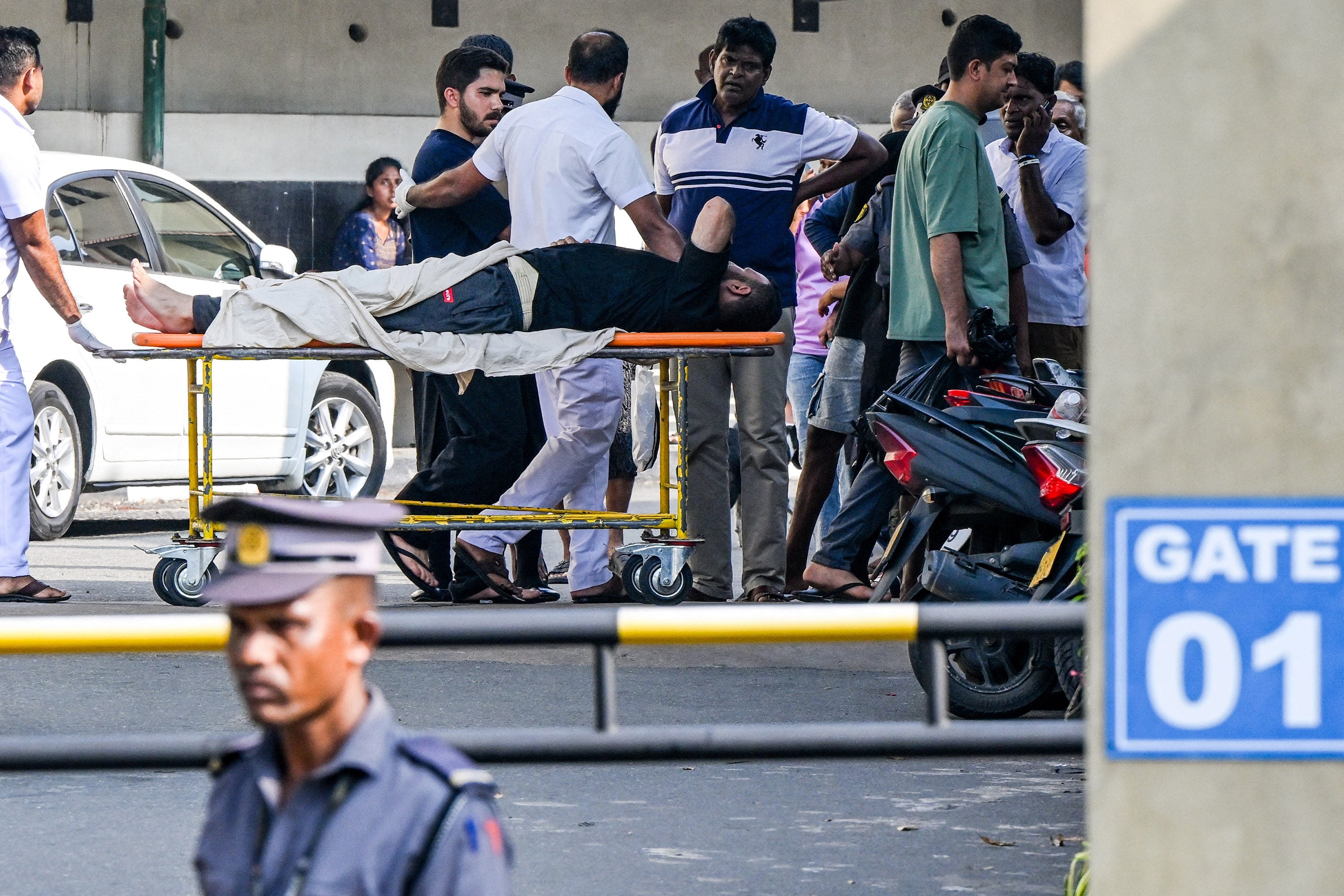 An injured Iranian sailor rescued from the IRIS Dena, after a US submarine torpedoed it off Sri Lanka’s coast amid the Middle East war, receives treatment at the Karapitiya hospital in Galle on Thursday. Photo: TNS