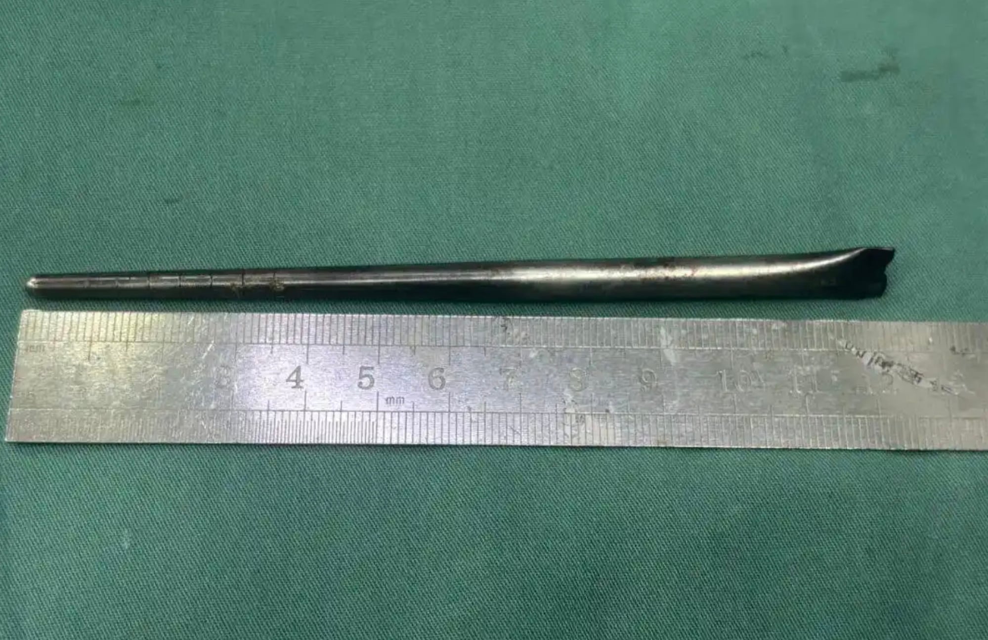 It is unclear how the man was able to swallow the 12cm-long metal chopstick, above. Photo: baijiahao.baidu.com It is unclear how the man was able to swallow the 12cm-long metal chopstick, above. Photo: baijiahao.baidu.com