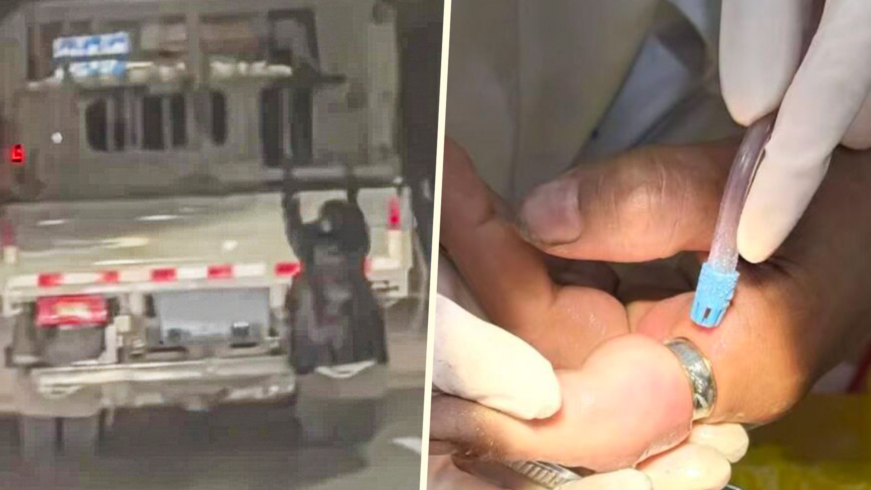 In China, a wife suspected her husband of cheating and clung to his truck to follow him; a woman needed a dentist’s help to remove a stuck ring and a man threatened divorce after a male doctor examined his pregnant wife. Photo: SCMP composite/Douyin/Jimu