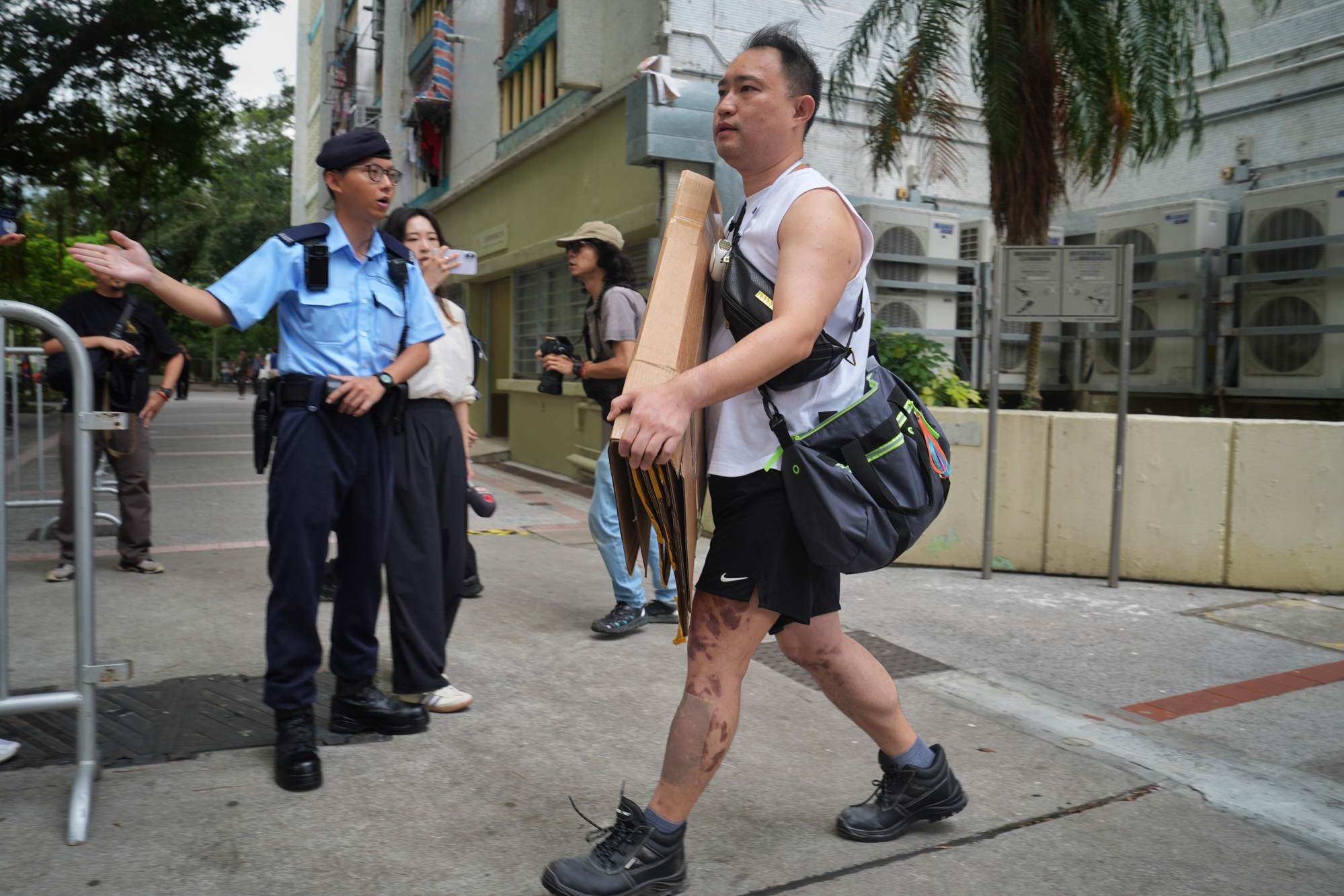 Survivor Lau says he suffered burns to 7.5 per cent of his body during his harrowing escape from the 20th floor of Wang Cheong House. Photo: Elson Li