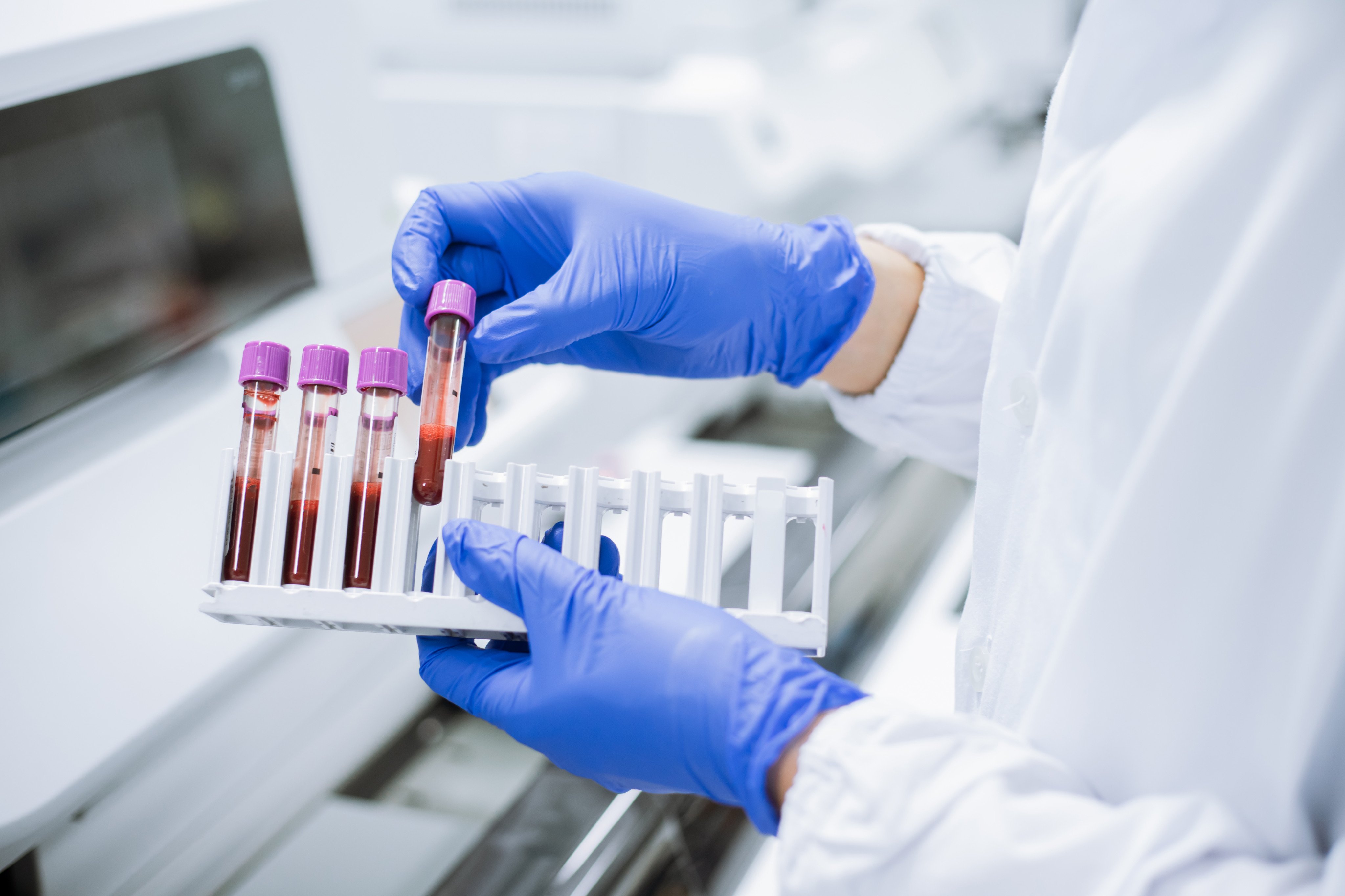 Your blood group is determined by the ABO system and the Rhesus system. Photo: Shutterstock