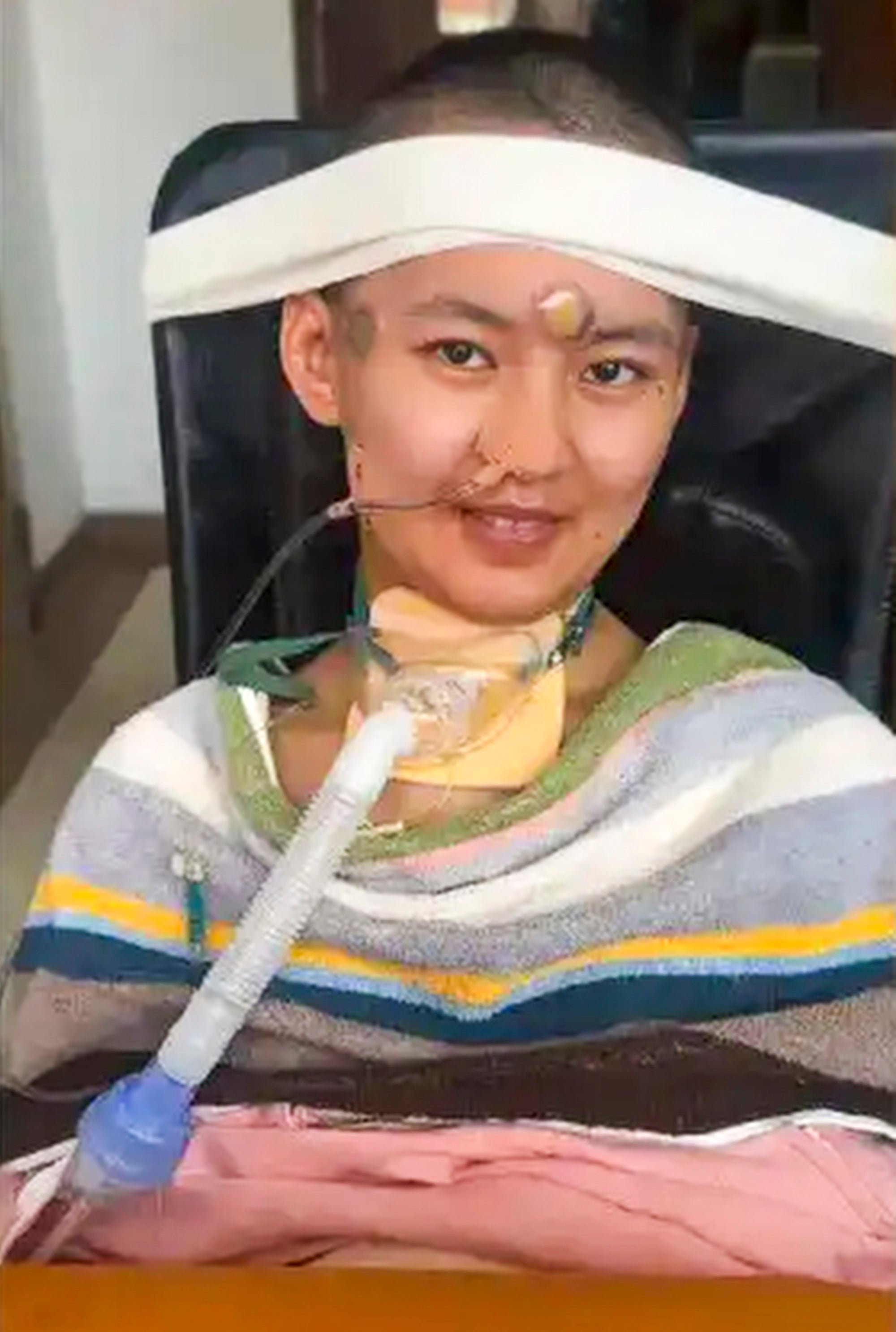 Wang, above, began to emerge from her coma after more than 90 days. Photo: Baidu
