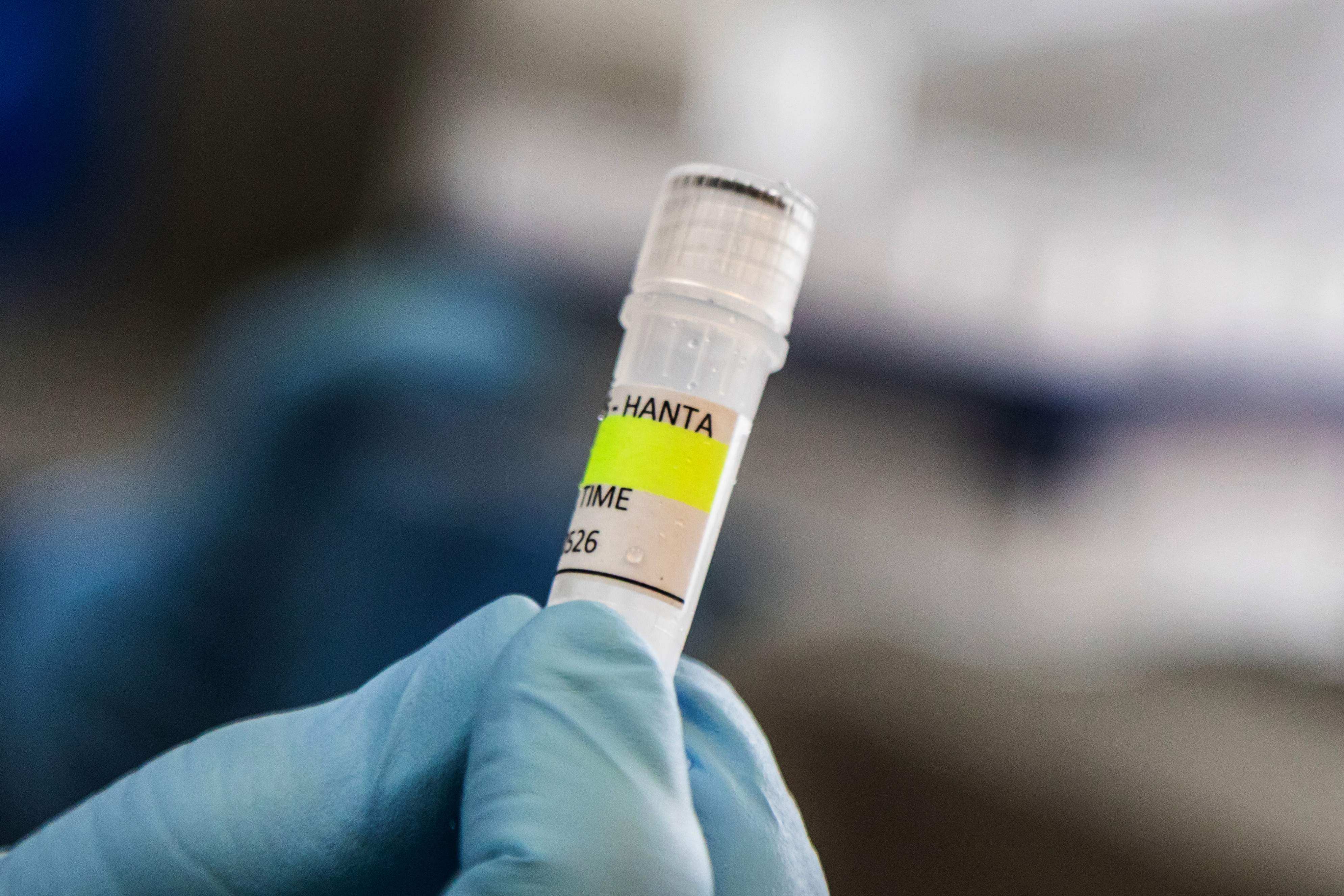 A scientist from the Malbran Institute holds a container used to diagnose the Andes hantavirus in Buenos Aires, Argentina, on Wednesday. Photo: Argentine Health Ministry via AFP