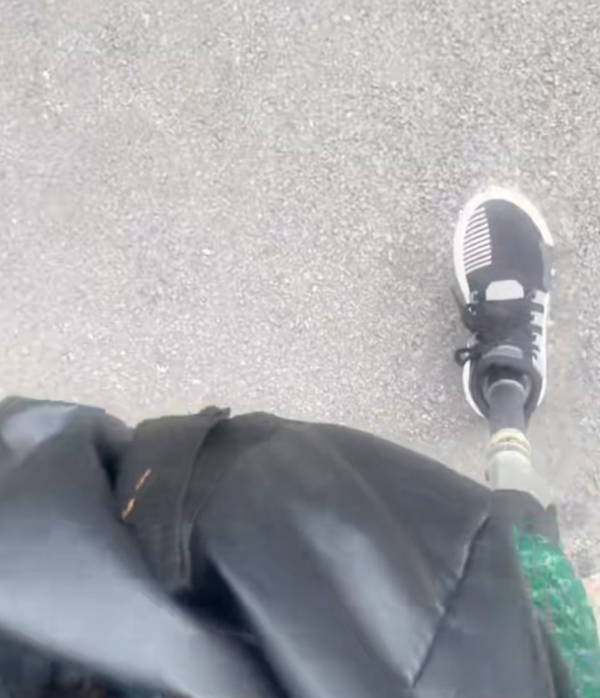 Liu shows the prosthetic limb which replaced the leg he lost in the road accident. Photo: Douyin Liu shows the prosthetic limb which replaced the leg he lost in the road accident. Photo: Douyin