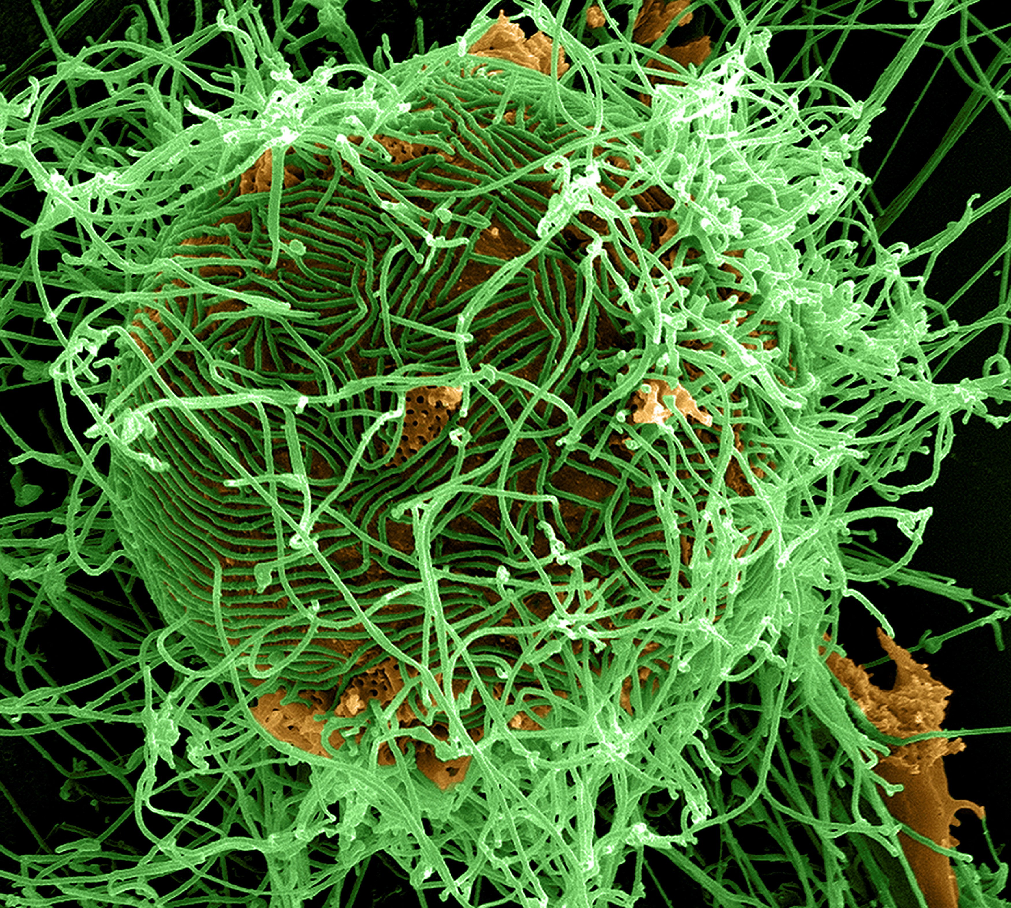 A digitally colourised scanning electron micrograph depiction shows numerous filamentous Ebola virus particles in green, budding from a chronically infected VERO E6 cell in orange. Photo: NIAID via Reuters