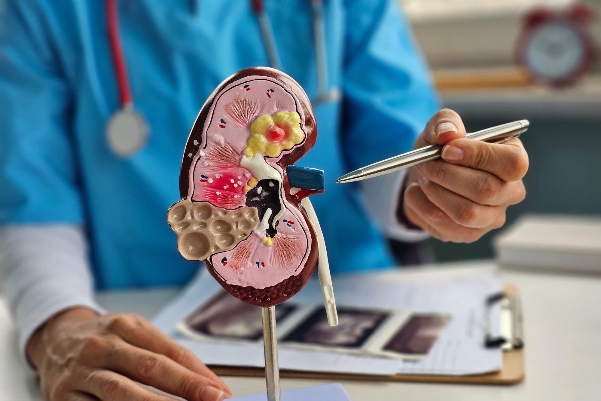A close-up photograph of a doctor holding a plastic model of a human kidney. Photo: Shutterstock A close-up photograph of a doctor holding a plastic model of a human kidney. Photo: Shutterstock