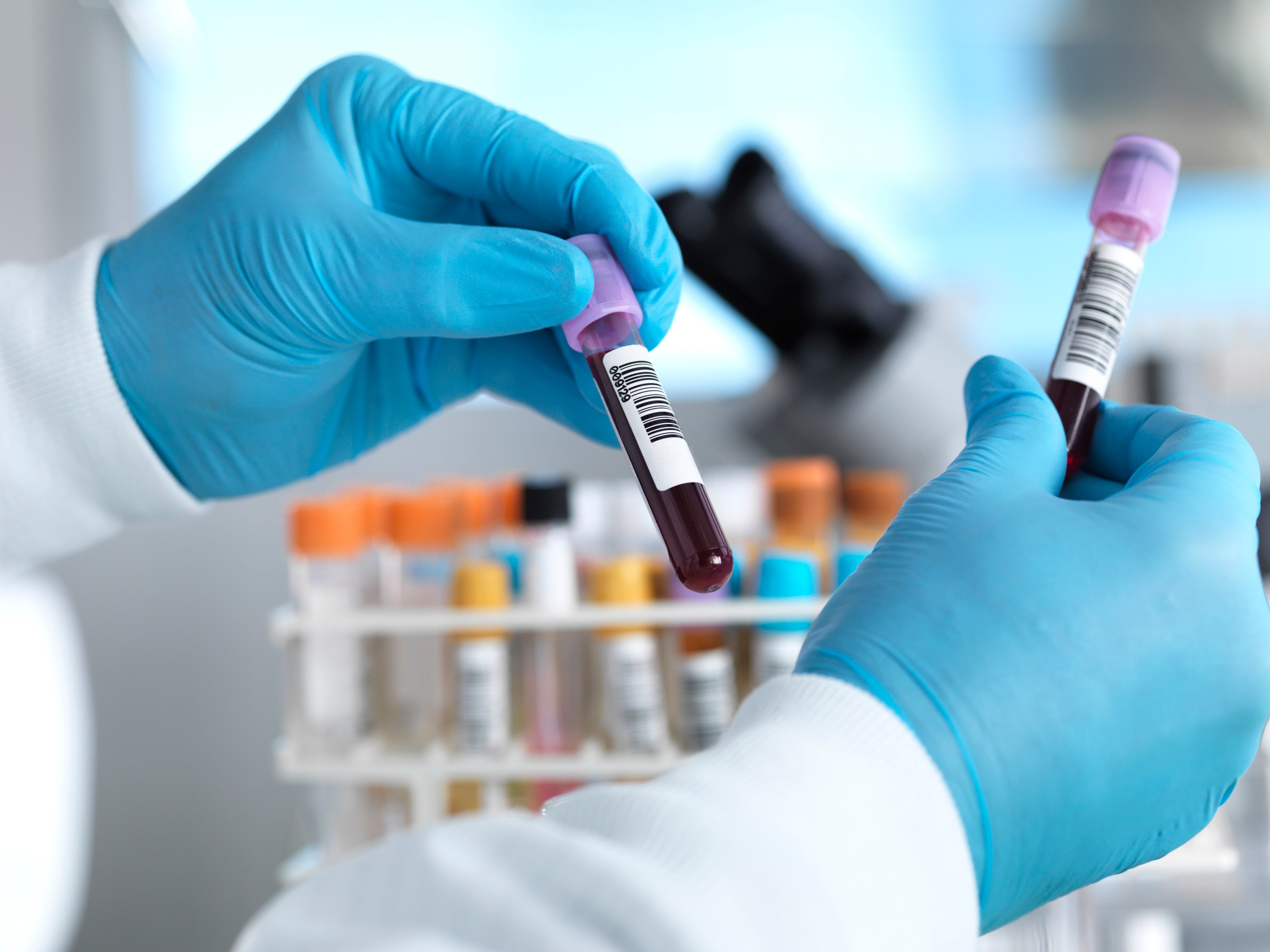 Knowing your blood group is important if you ever want to donate blood. Photo: Getty Images