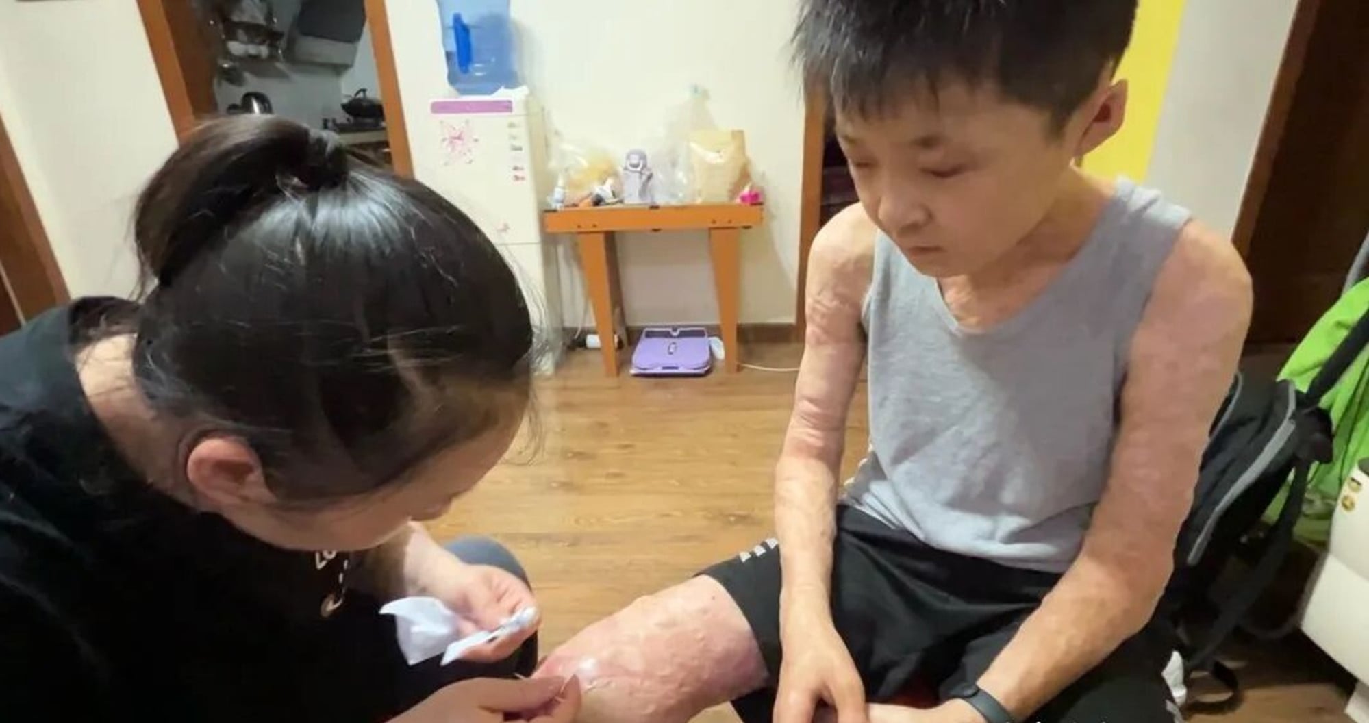 Xuanxuan receives treatment for his wounds which cause him much pain. Photo: cbgc.scol.com.cn Xuanxuan receives treatment for his wounds which cause him much pain. Photo: cbgc.scol.com.cn
