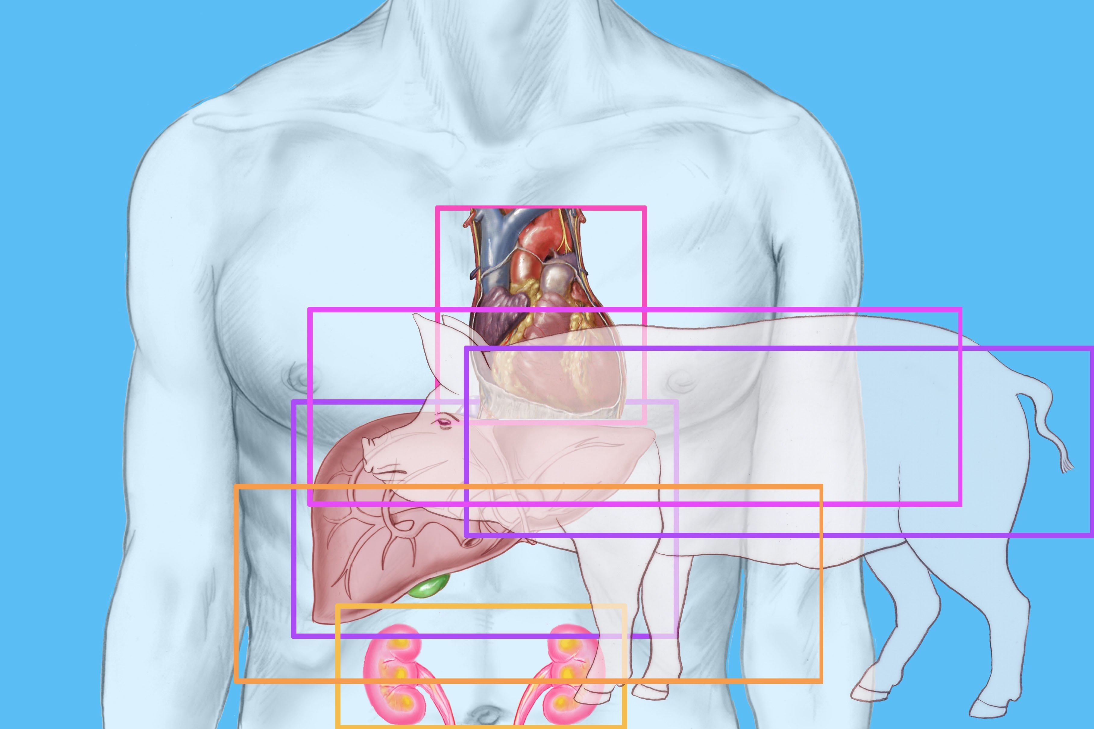Despite the potential of animal-to-human xenotransplantation, there are still many barriers scientists and doctors have to overcome before it can become a clinical practice. Photo: Universal Images Group via Getty Images
