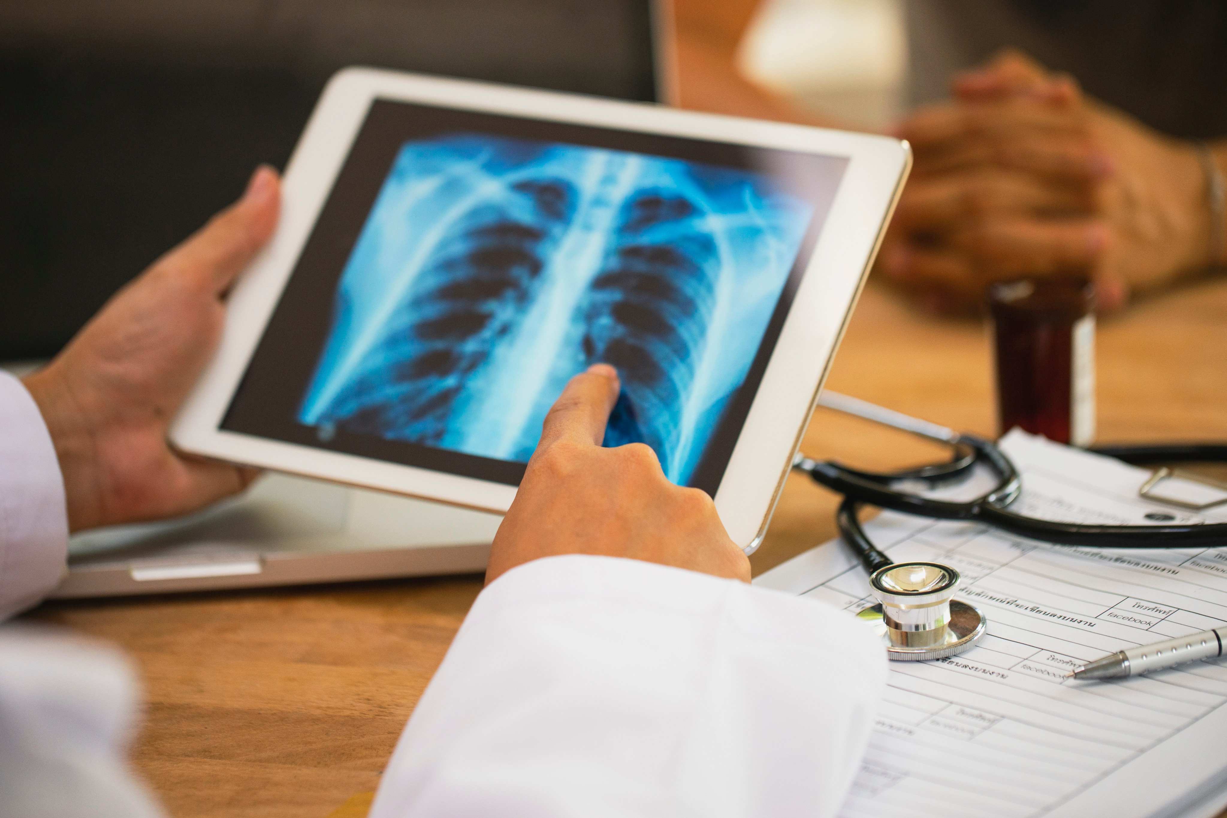 The study followed 296 previously untreated patients with advanced ALK-positive non-small cell lung cancer.  Photo: Getty Images