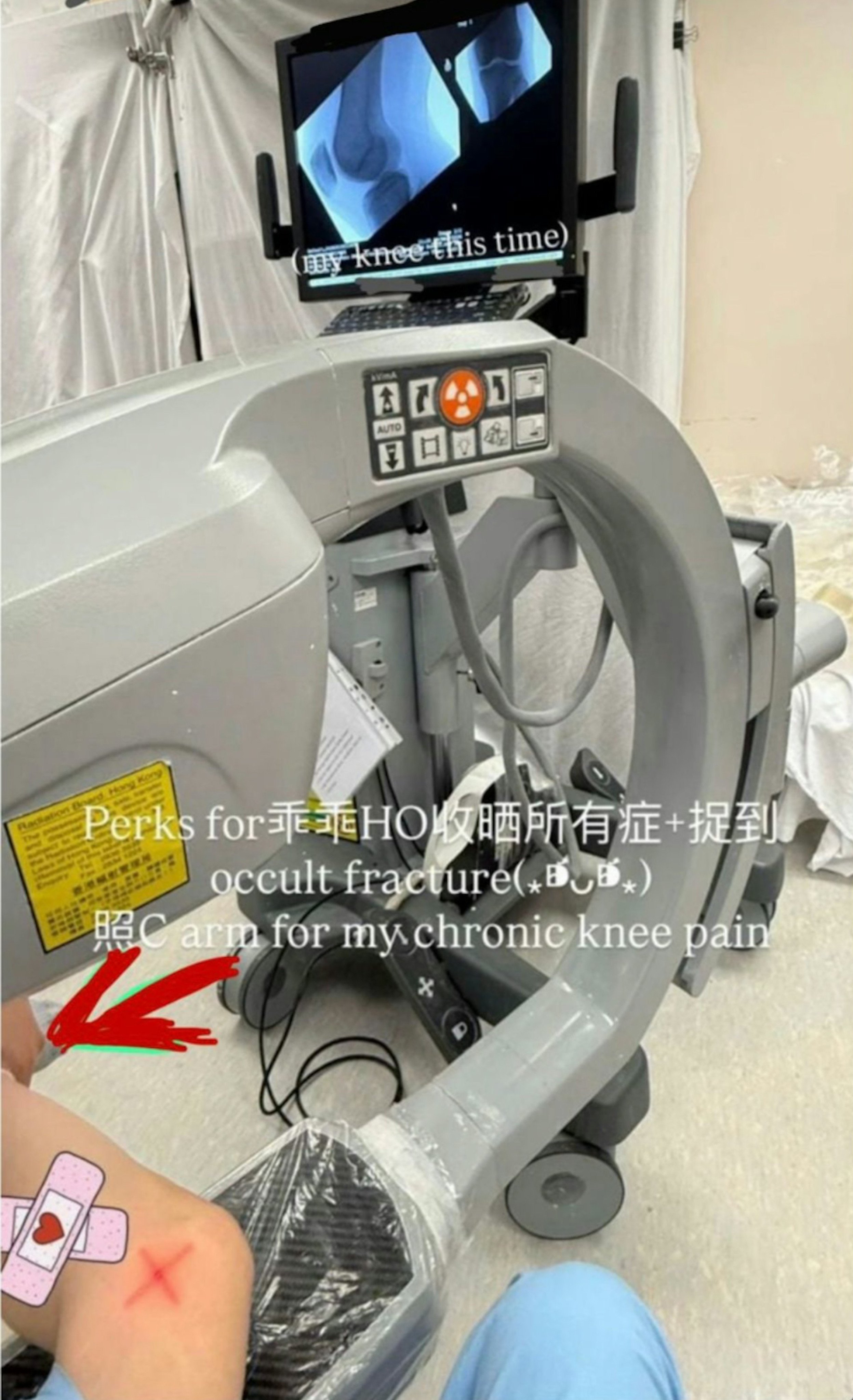 The trainee posted photos on social media of having X-ray sessions on her knee. Photo: Handout