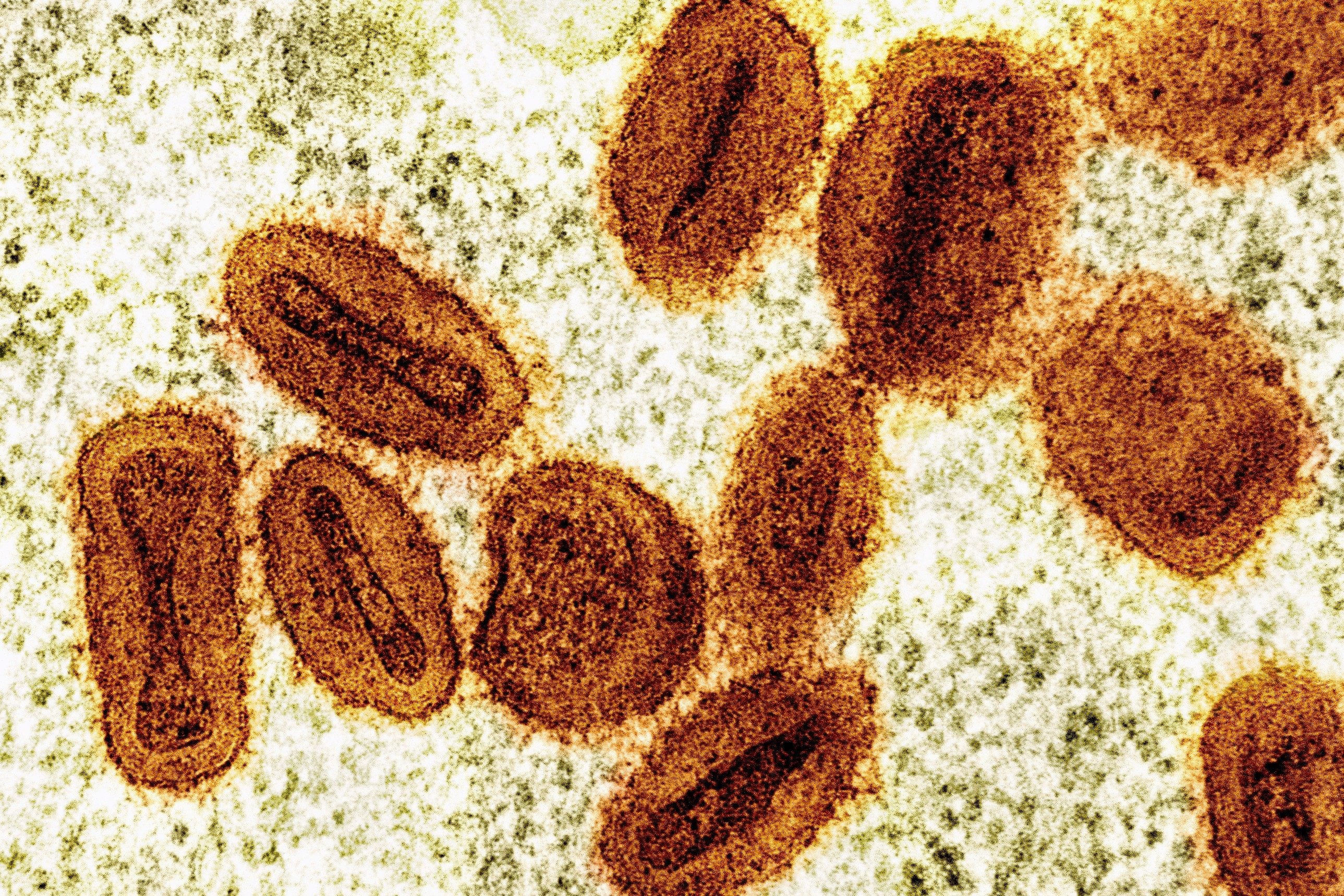5 Mpox cases linked to Hong Kong ‘premier’ gay sauna, contact tracing ...