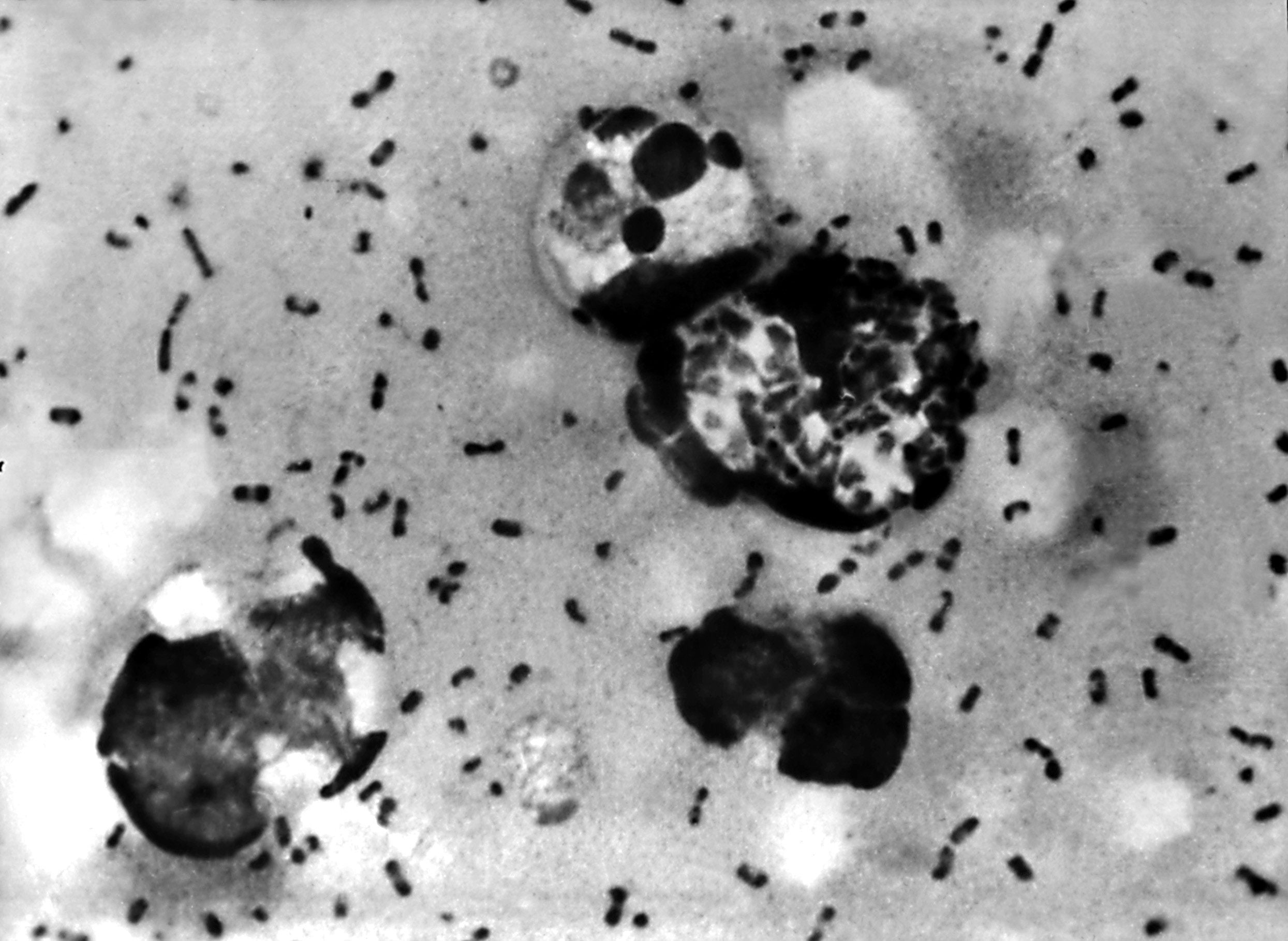 Yersinia pestis, the bacteria responsible for the plague. New DNA analysis reveals the pathogen was causing deadly outbreaks 5,500 years ago. Photo: Shutterstock