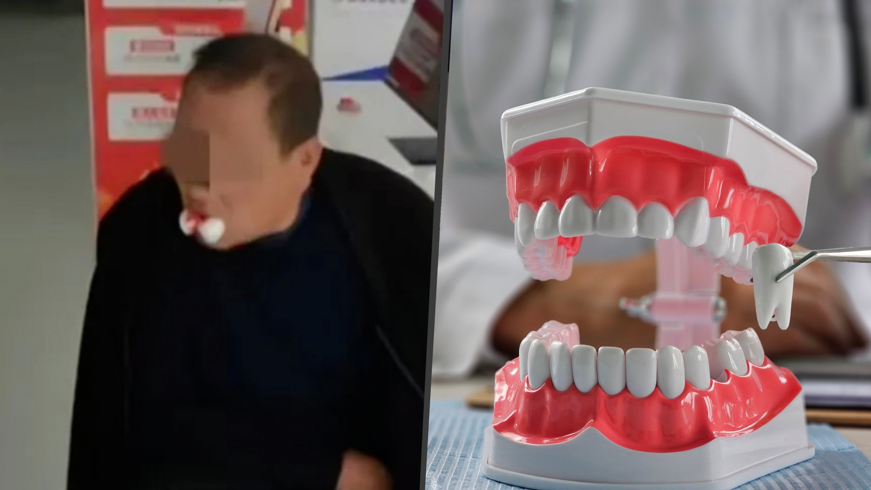 A Chinese clinic extracted 12 teeth from a 63-year-old man who had complained of just a single toothache, completely ignoring his pre-existing high blood pressure. Photo: SCMP composite/The Paper/Shutterstock
