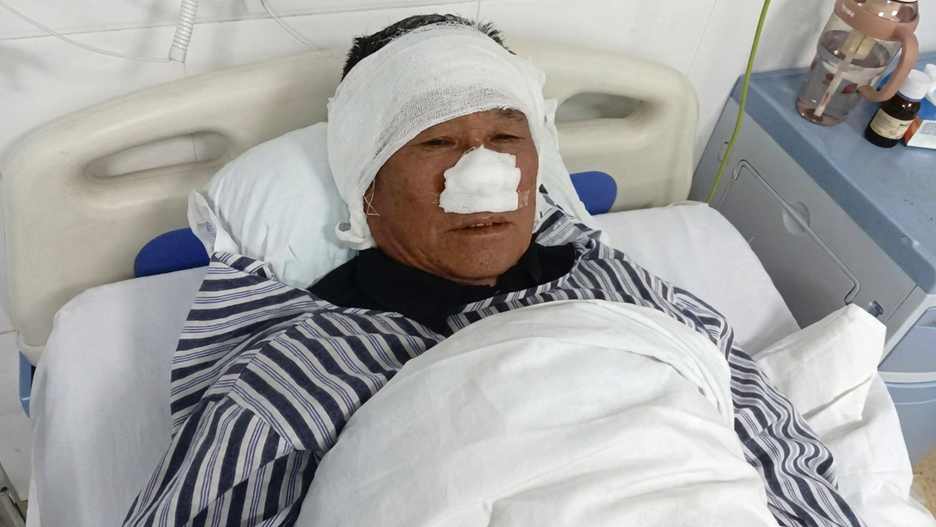 A 69-year-old Chinese hero had his nose bitten off while shielding a woman from a violent attacker and holding the suspect down for police. Photo: QQ.com