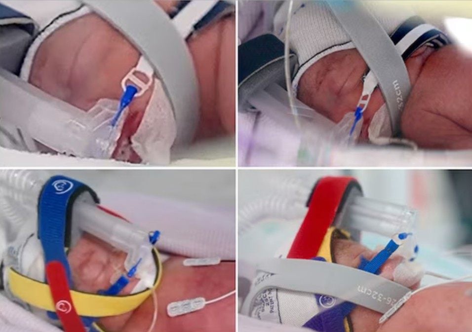 The identical quadruplet girls in incubators. Photo: Metro North Health/Royal Brisbane and Women’s Hospital
