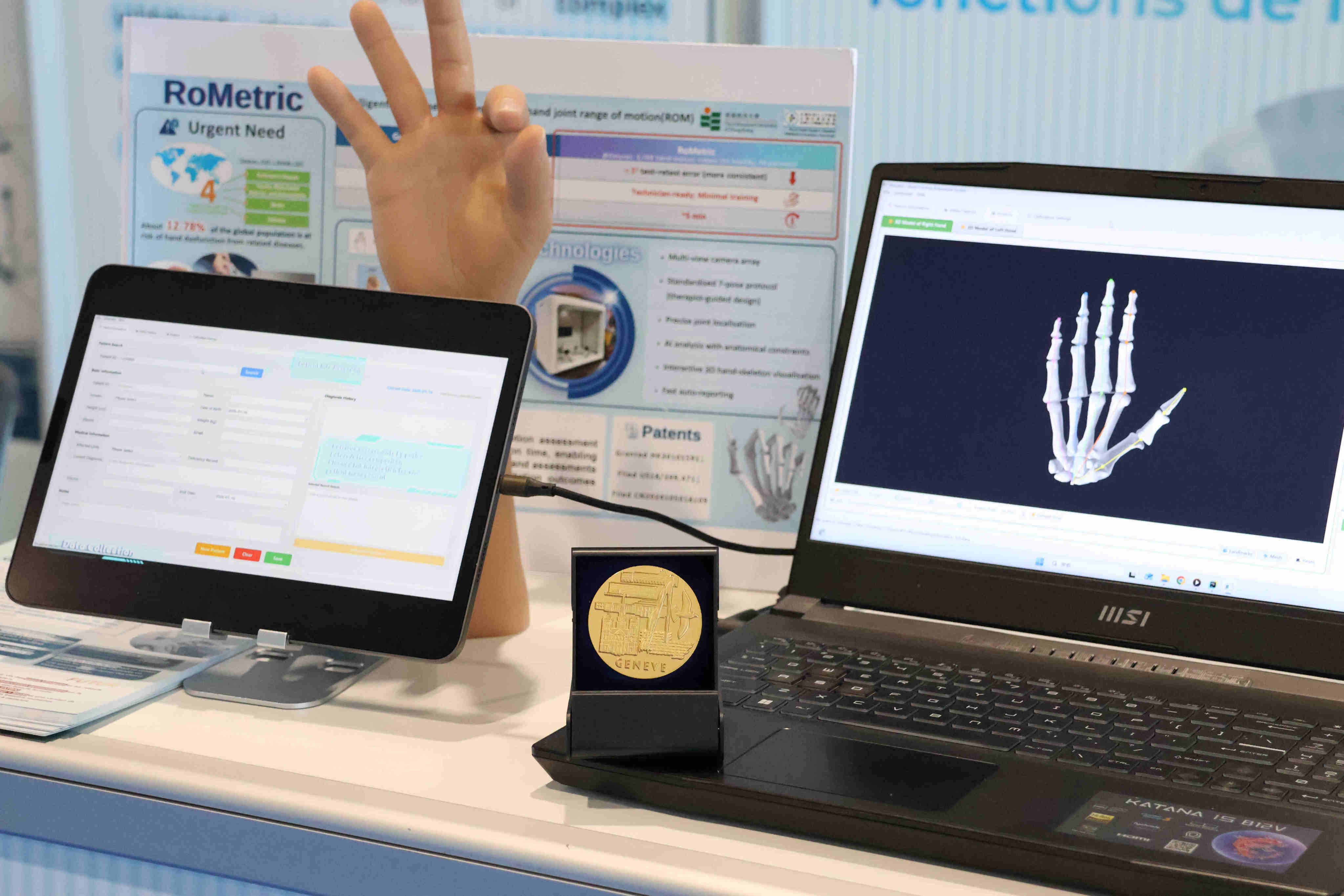 RoMetric can automatically measure 15 hand joints in three dimensions, reducing assessment time by up to 87 per cent and providing objective data to support rehabilitation planning. Photo: Handout