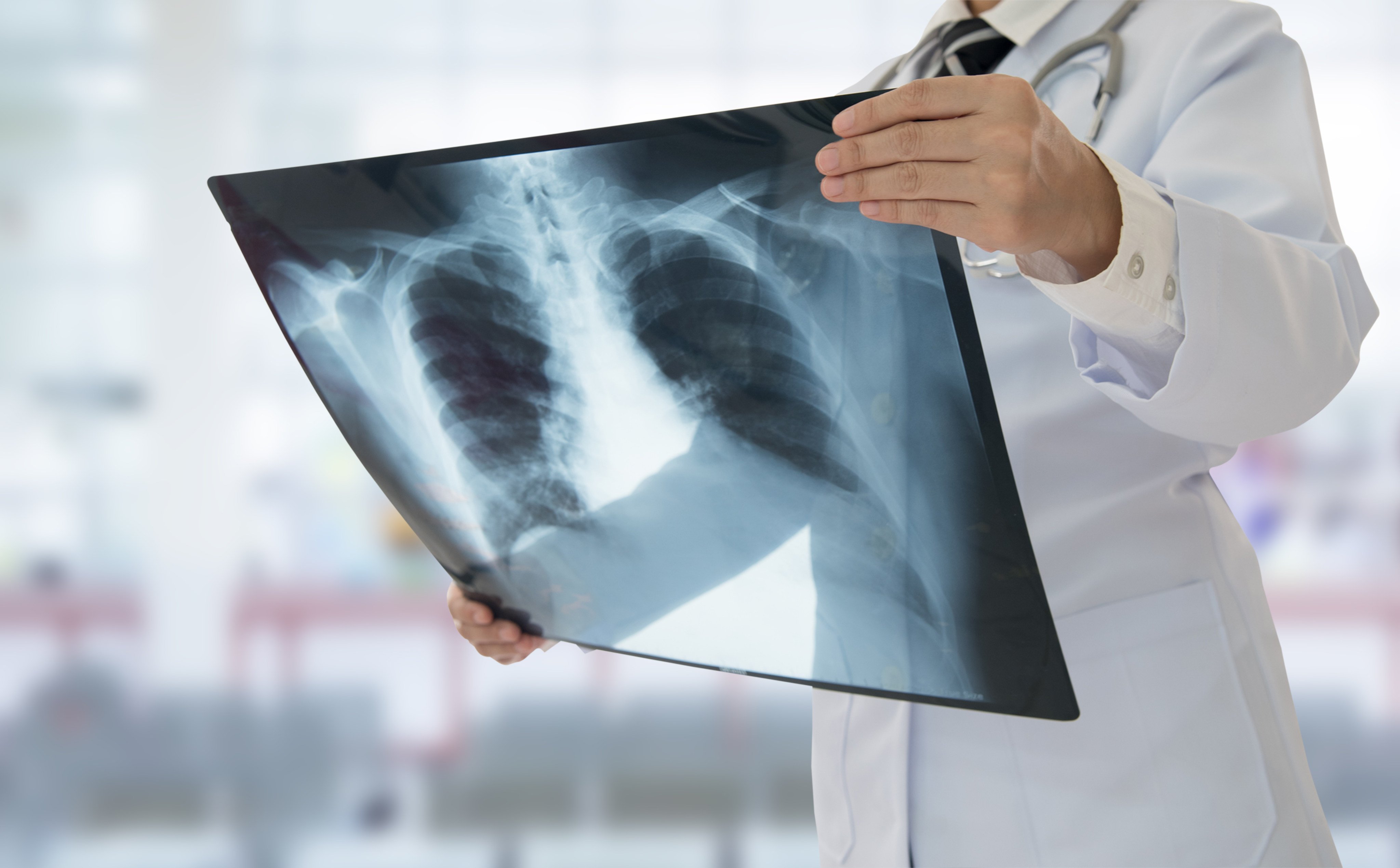 China’s tabletop X-ray ghost imaging method could be used to capture dynamic objects such as rotating aircraft engines or biological movements like a beating heart. Photo: Shutterstock