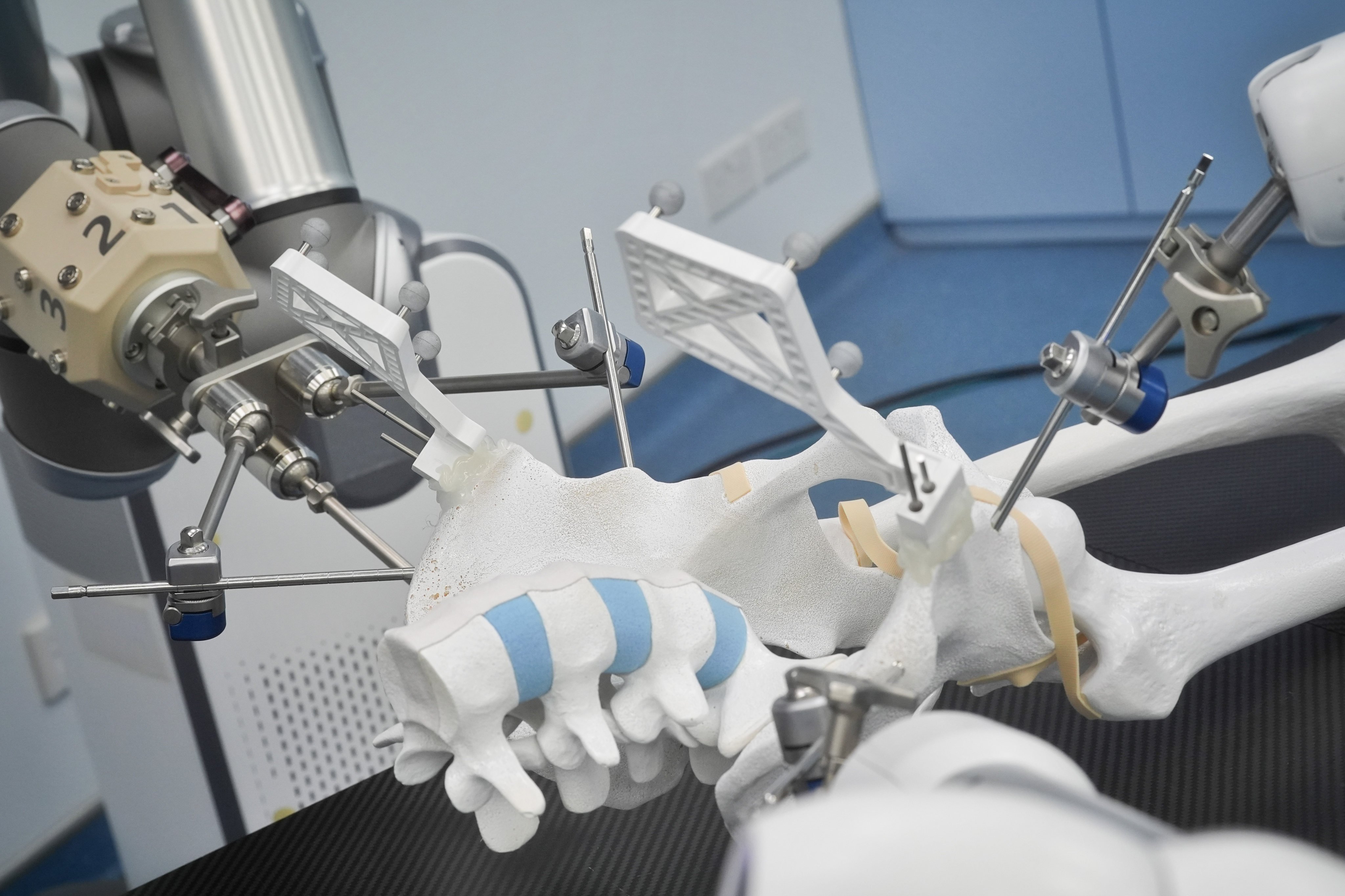 CUHK researchers have performed Hong Kong’s first robotic-assisted pelvic fracture surgery. Photo: Elson Li