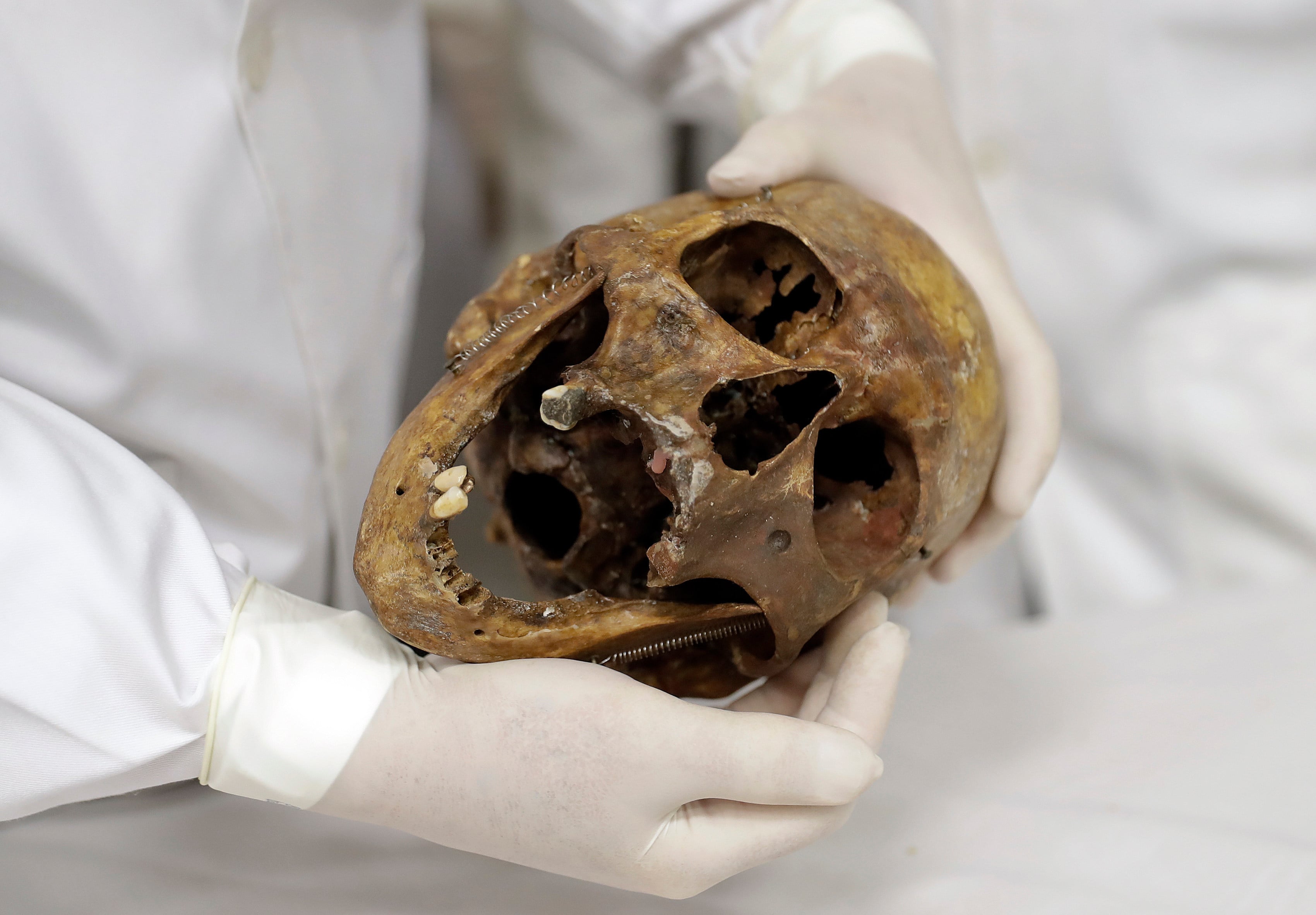 Forensic doctor Daniel Munoz shows the skull of Nazi war criminal Josef Mengele at the school of medicine of Sao Paulo University in Brazil in December 2016. Photo: AP