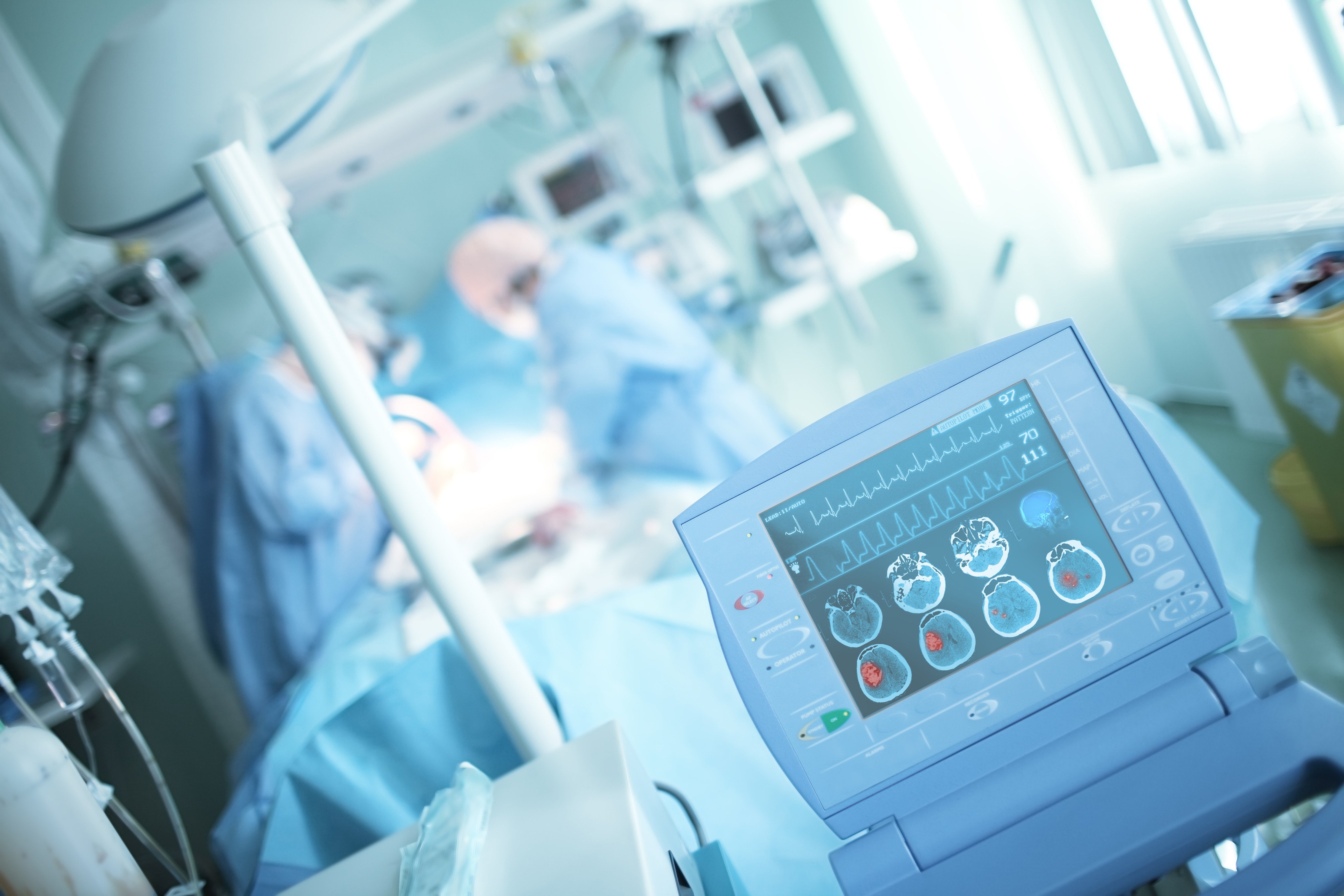 Nearly 12 million new cases of stroke occur worldwide each year, roughly equivalent to one every three seconds or less. Photo: Shutterstock