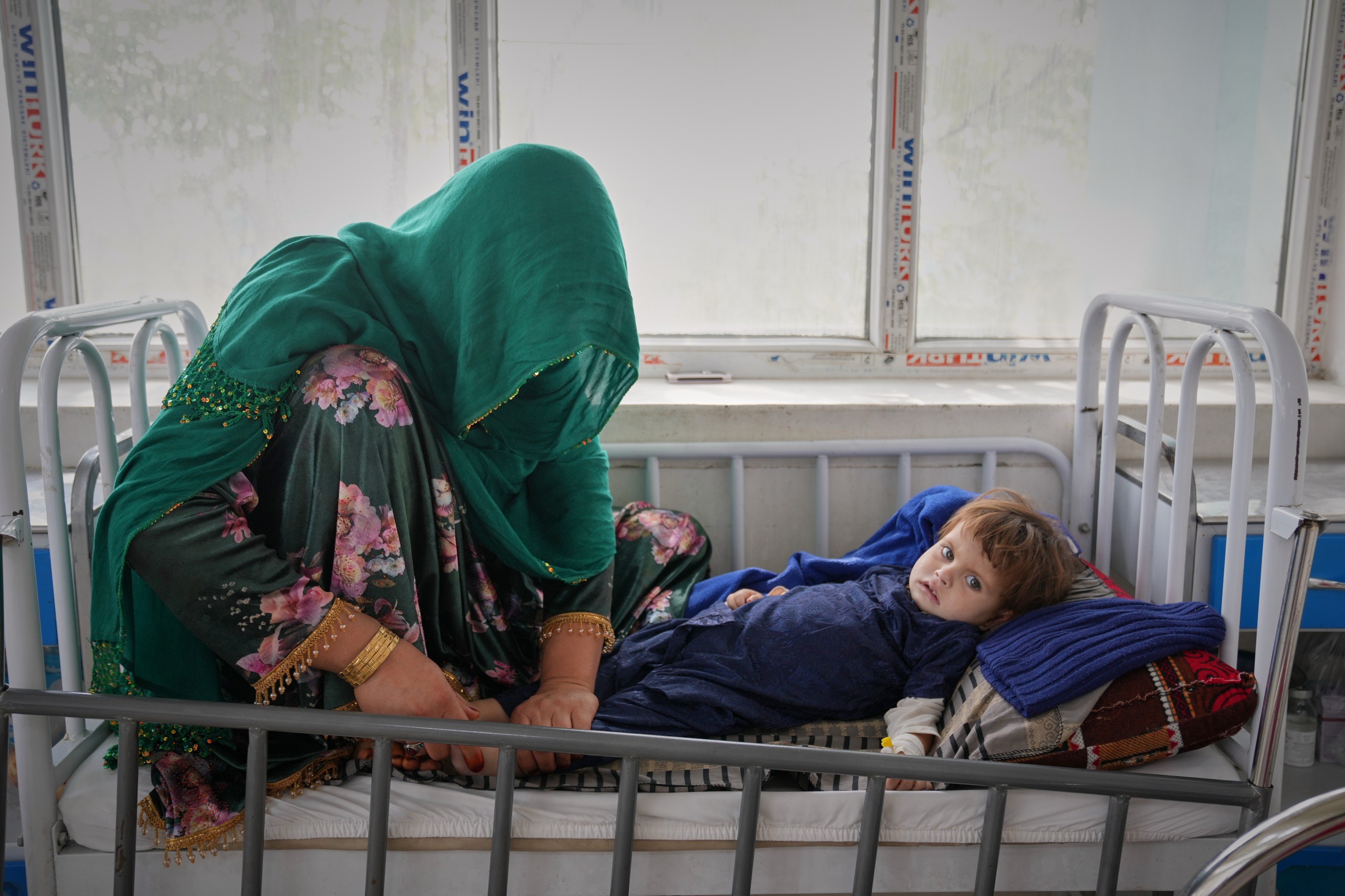 Malika, 25, tends to her three-year-old daughter, Kalsoum, who has symptoms of malnutrition, at Indira Gandhi children’s hospital in Kabul, Afghanistan, on October 12. Photo: AP