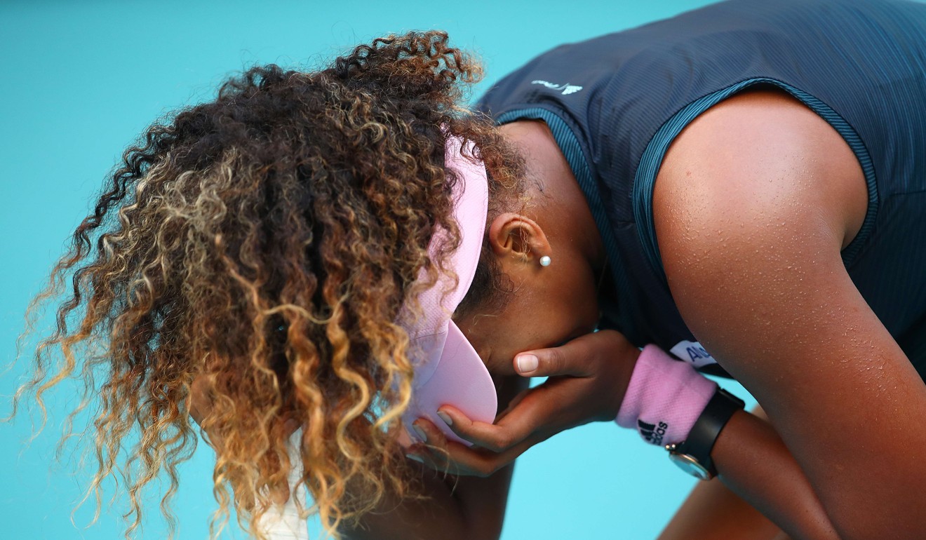 Naomi Osaka reacts in her match against Su-Wei Hsieh. Photo: AFP