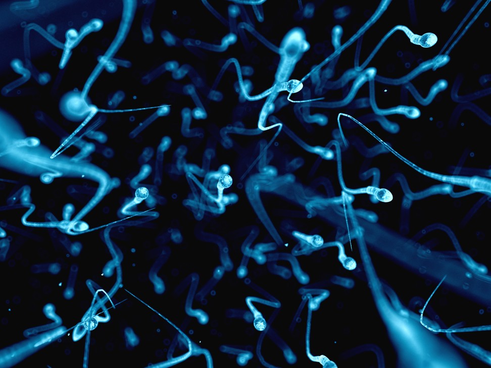 When assessing sperm, doctors look at three main measures: concentration, motility and morphology. Photo: Alamy