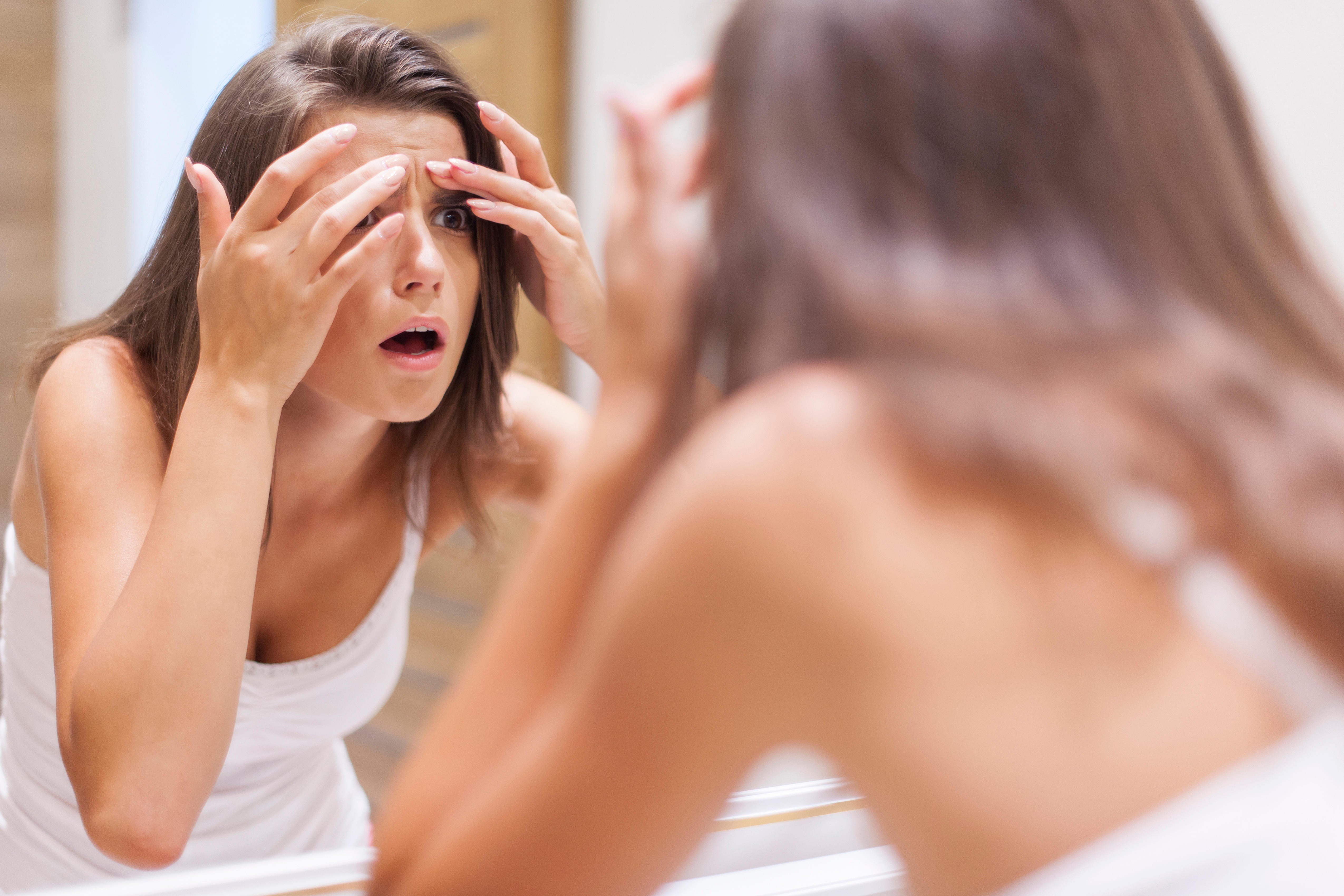Don’t pop those pimples! A skincare expert shares tips on healthy skin. Photo: Alamy