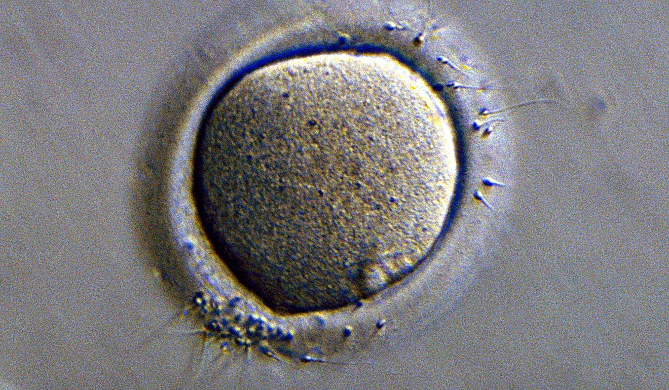 Sperm in the process of fertilising a human egg cell. Photo: Alamy