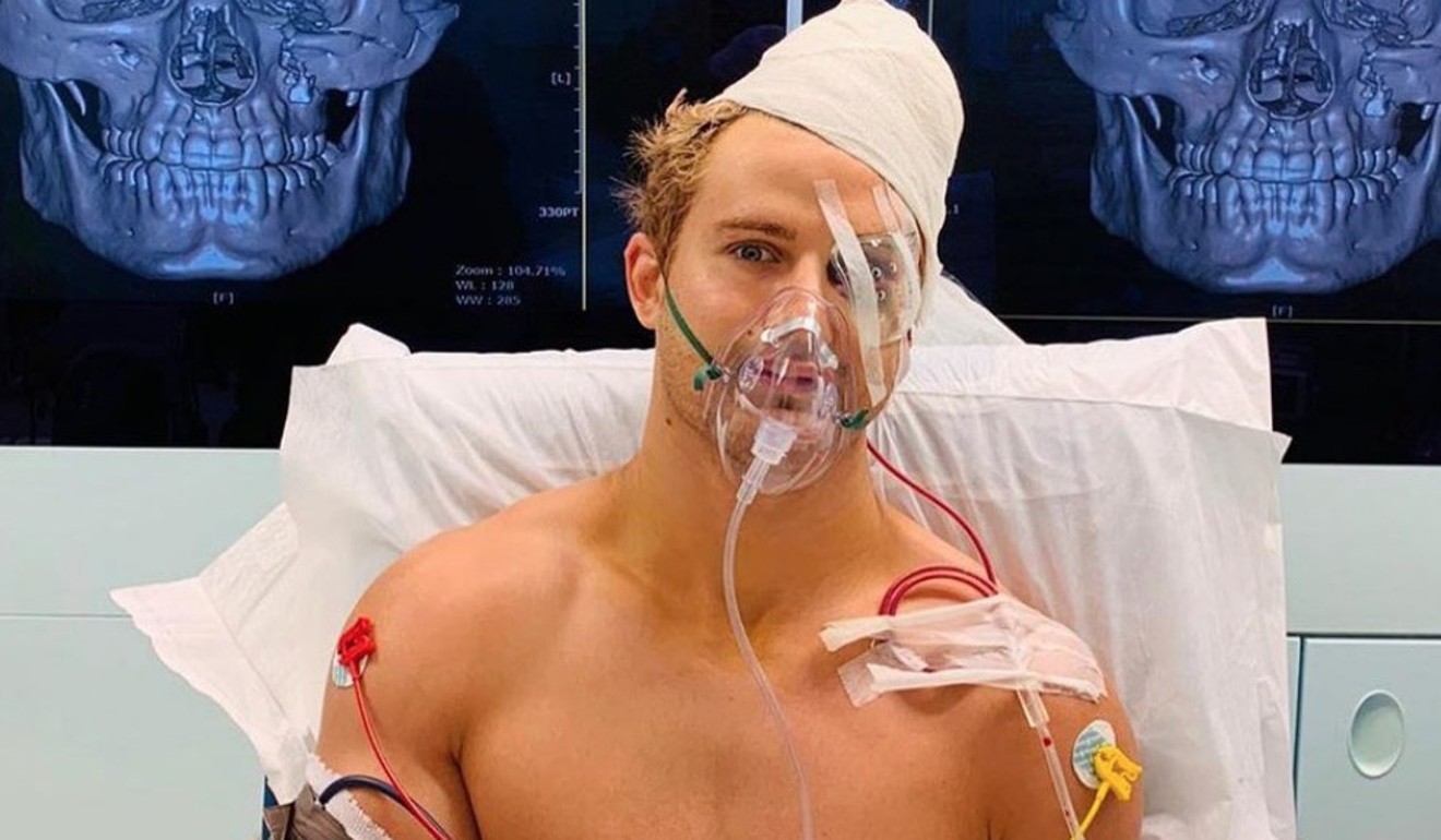 Sage Northcutt is recovering after an ‘intense’ operation on nine facial fractures. Photo: Instagram
