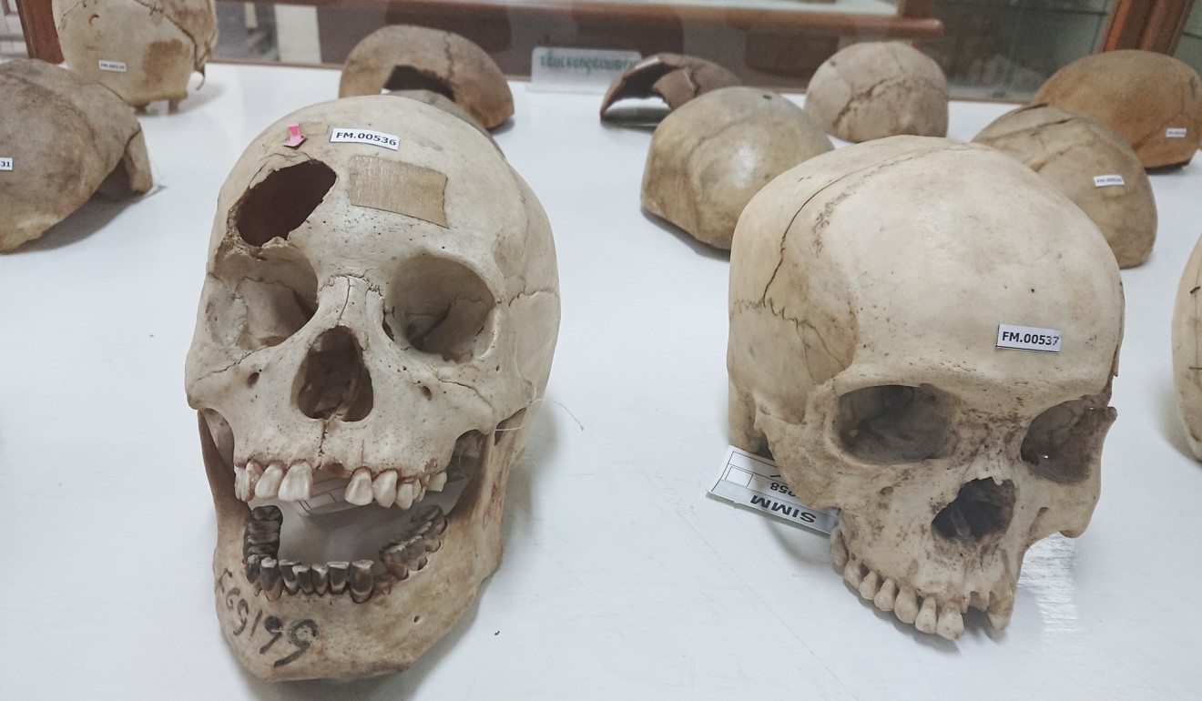 Skulls of murder victims on display at the Forensic Medicine Museum in Bangkok. Photo: Tibor Krausz