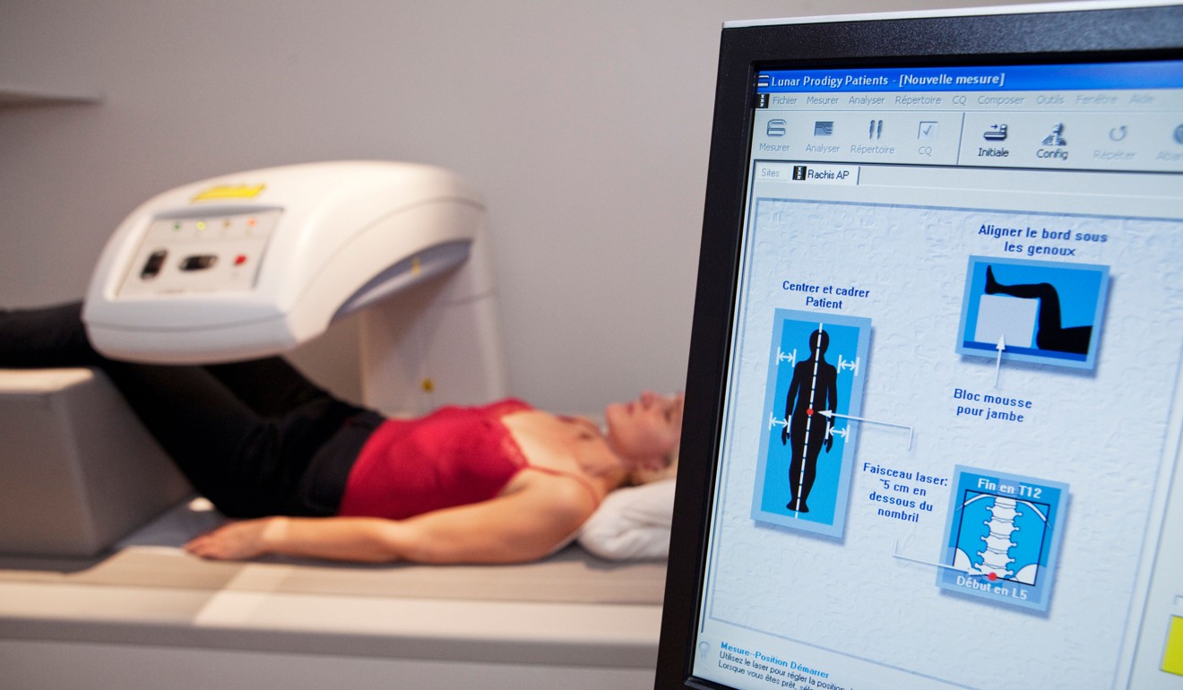 A bone density examination will show if you have osteopenia, or the more serious osteoporosis. Photo: Alamy