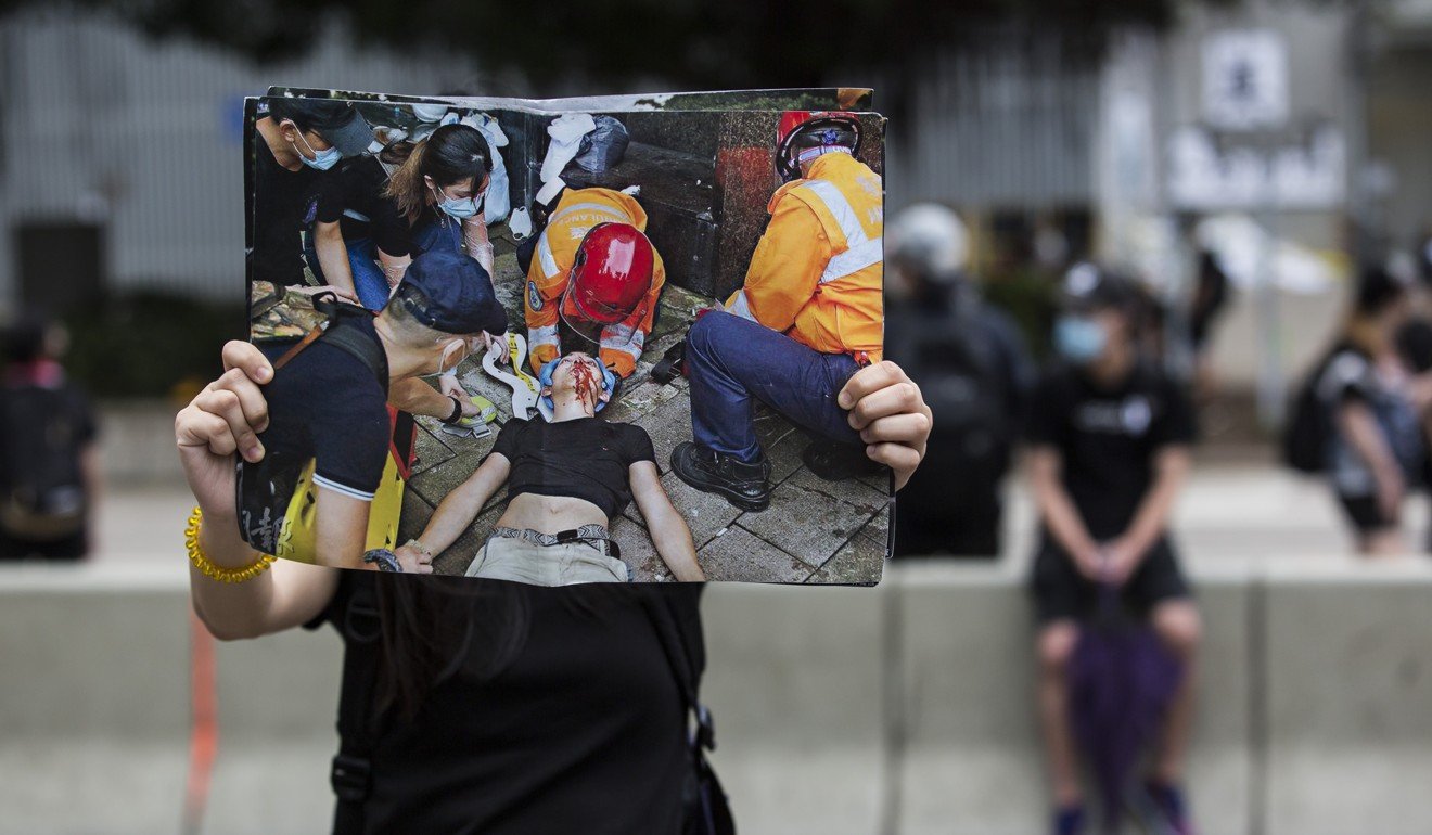A protester holds up an image of the Hong Kong student injured during violent clashes with police. Photo: AFP