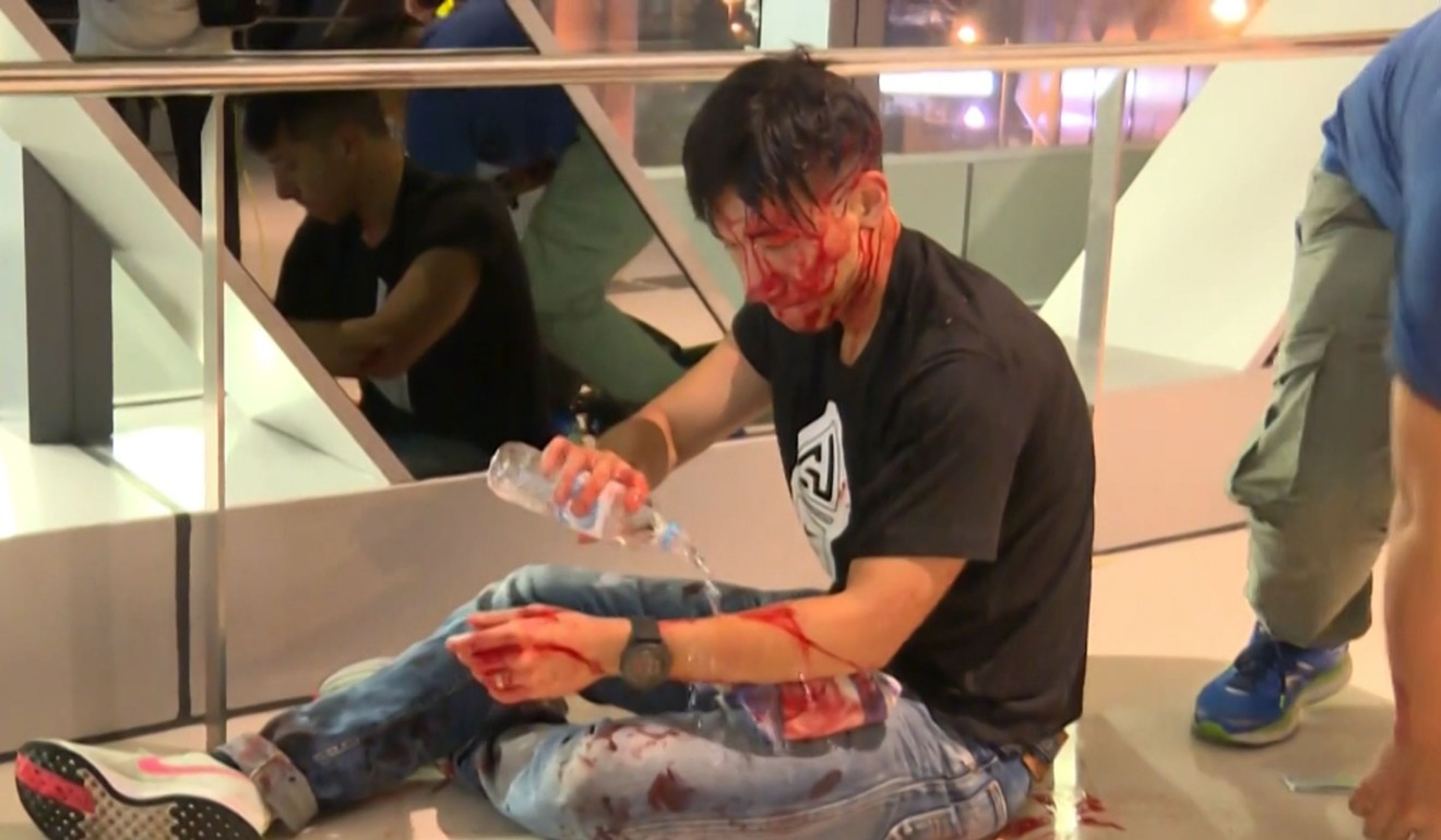 Screengrab from a video recorded by broadcaster Now TV on July 21, 2019 sportscaster for local television station TVB, Ryan Lau bleeding after a mob of suspected triad gangsters attacked pro-democracy protesters returning from a demonstration. Photo: AFP