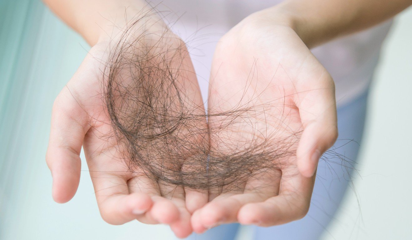 More than half of the Chinese students who took part in a China Youth Daily survey said they had hair loss. Photo Shutterstock