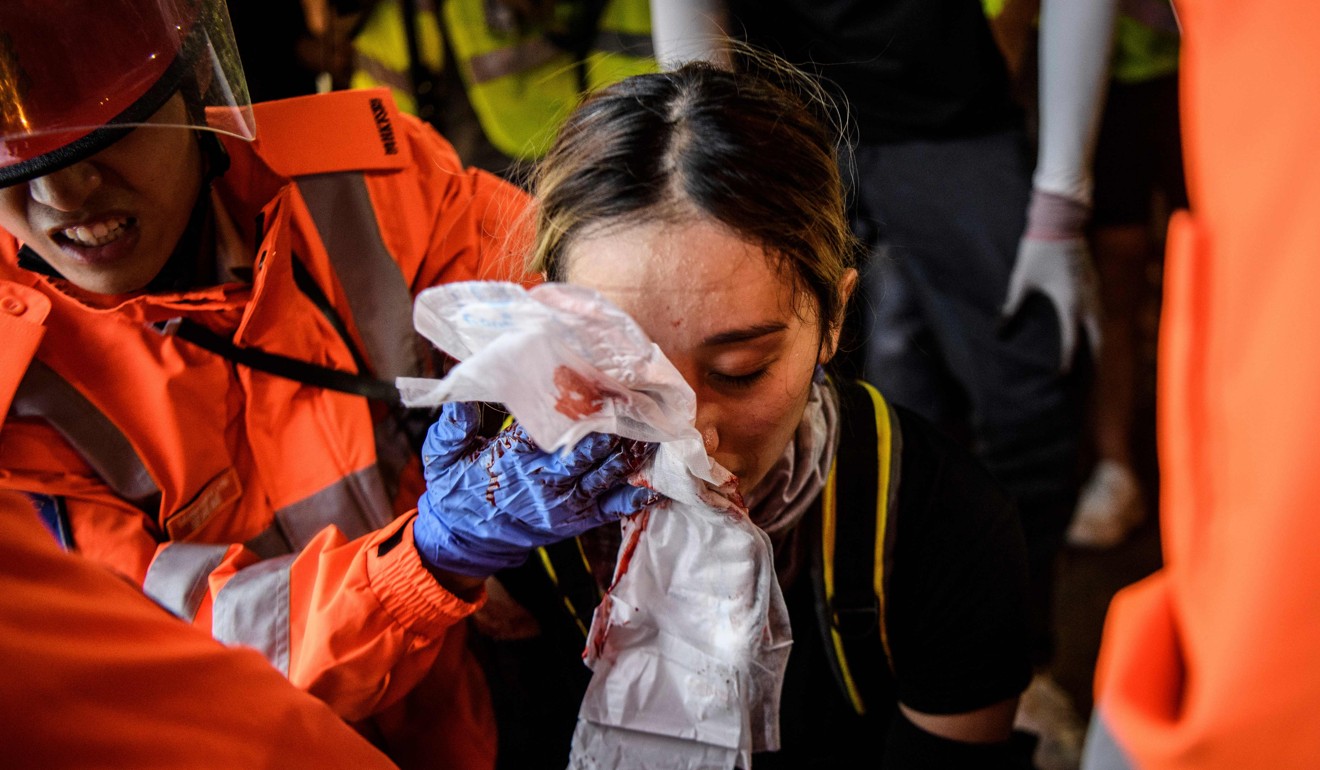 Medics look after a woman who received a facial injury during a stand-off between protesters and police in Tsim Sha Tsui in Hong Kong on August 11. Photo: AFP