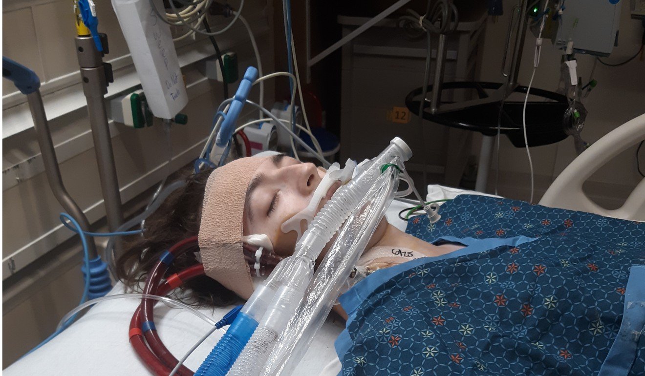 Alexander Mitchell's lungs had stopped working and he was in intensive care on two different life support systems for about a week. He eventually recovered. Photo: Handout