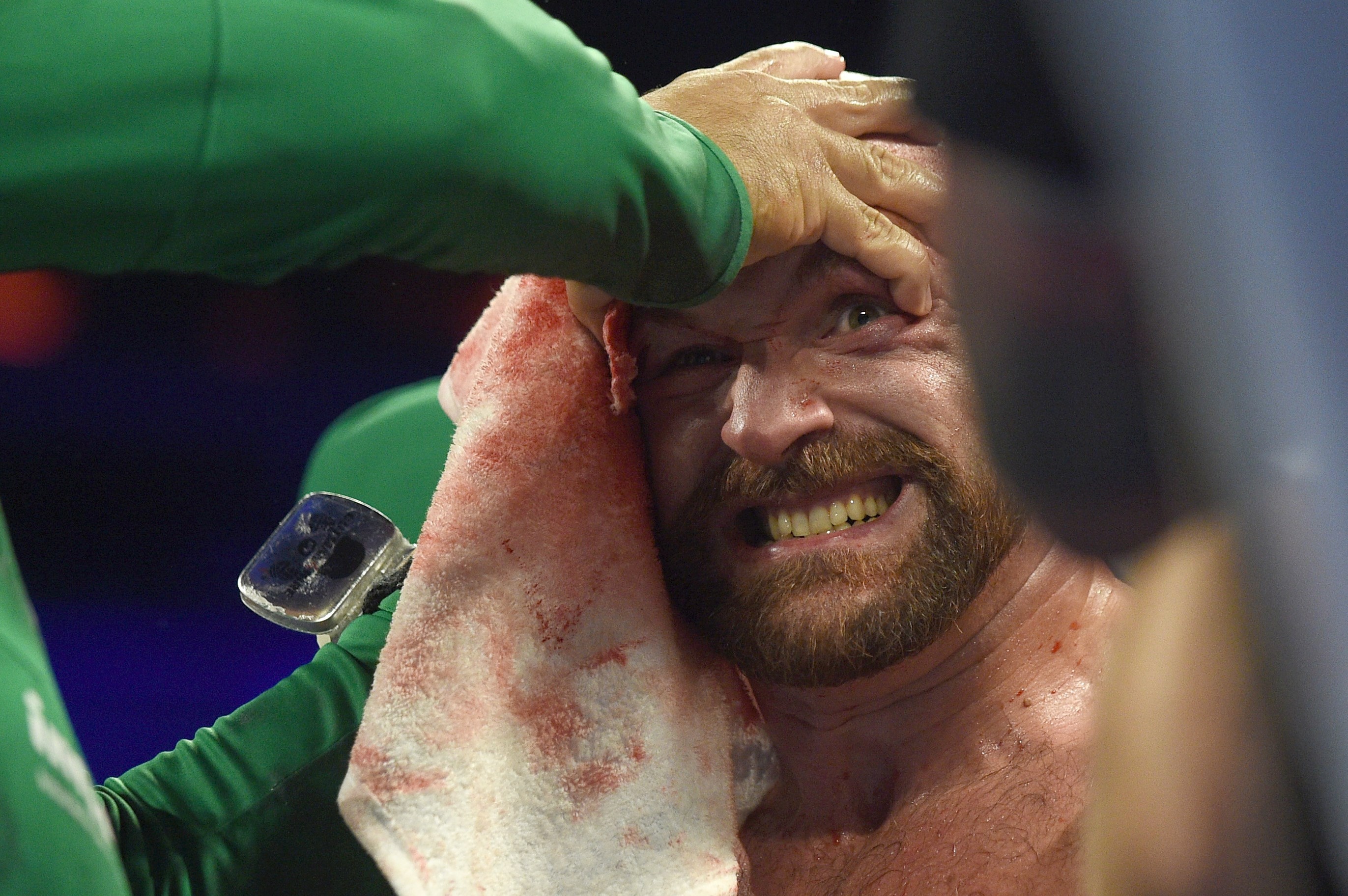 Tyson Fury is tended to in his corner between rounds during his heavyweight bout against Otto Wallin. Photo: AFP