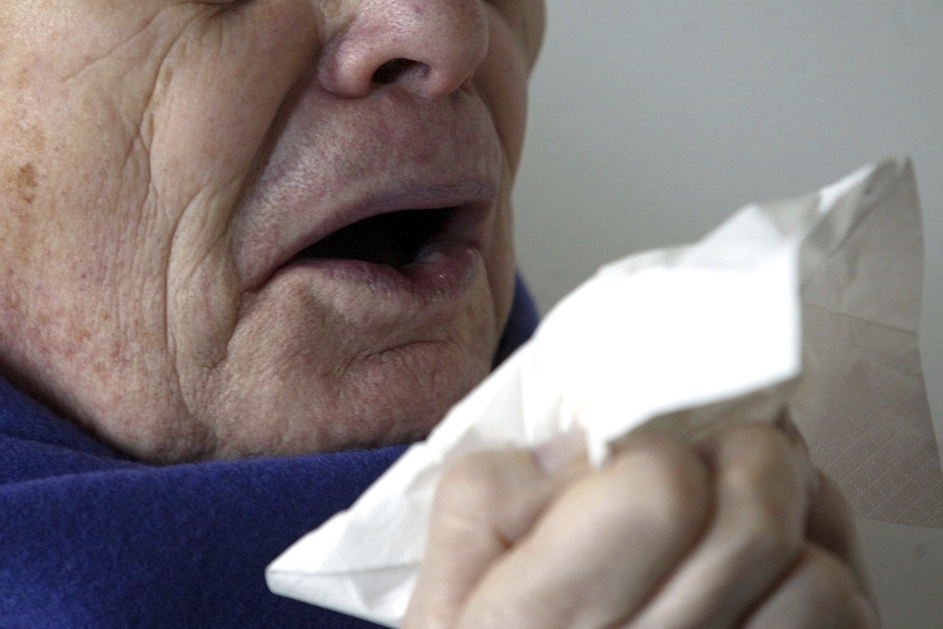 Cure for common cold 'possible' after US scientists find key
