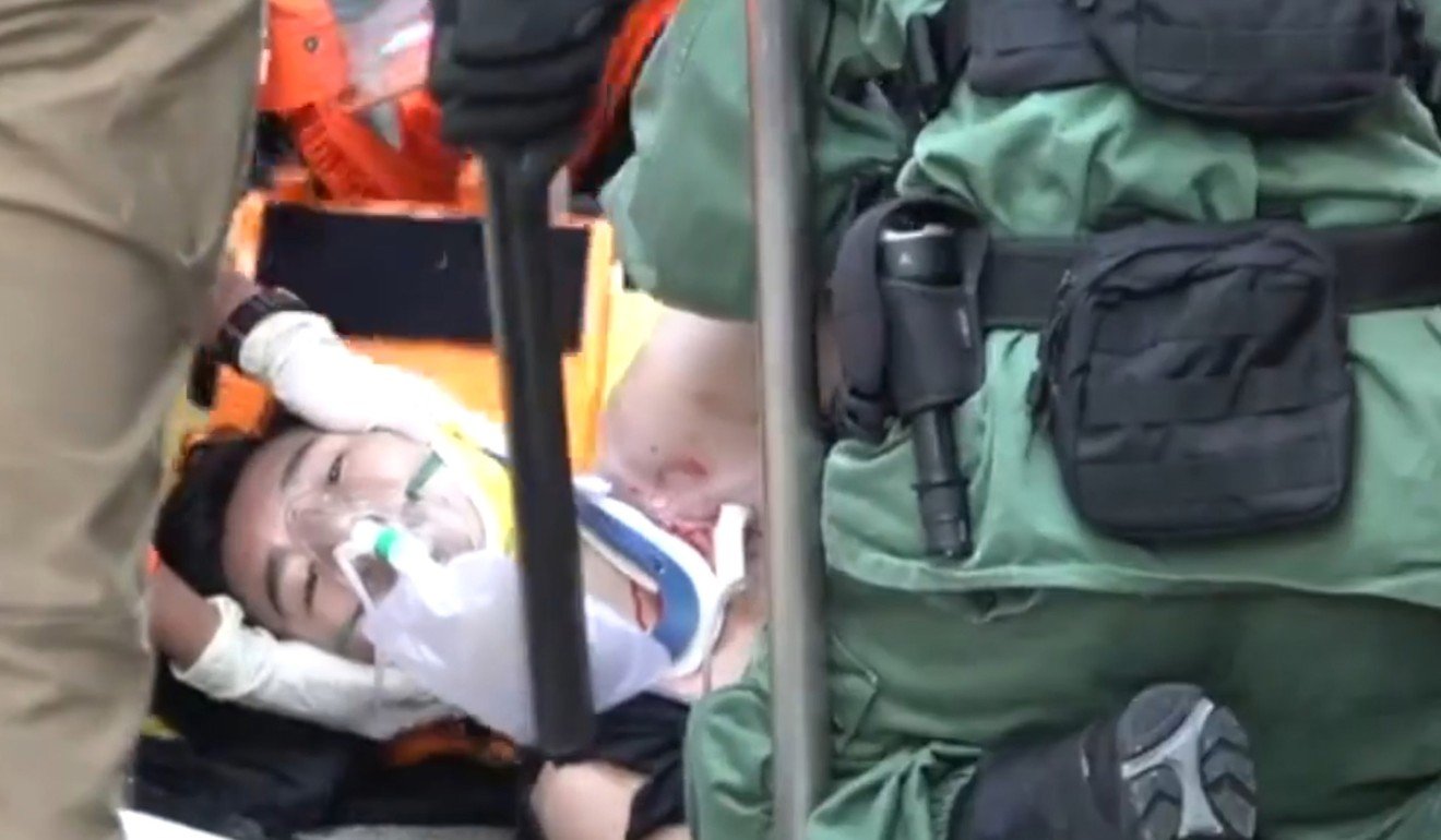 The 18-year-old protester underwent surgery and is in critical condition. Photo: Handout
