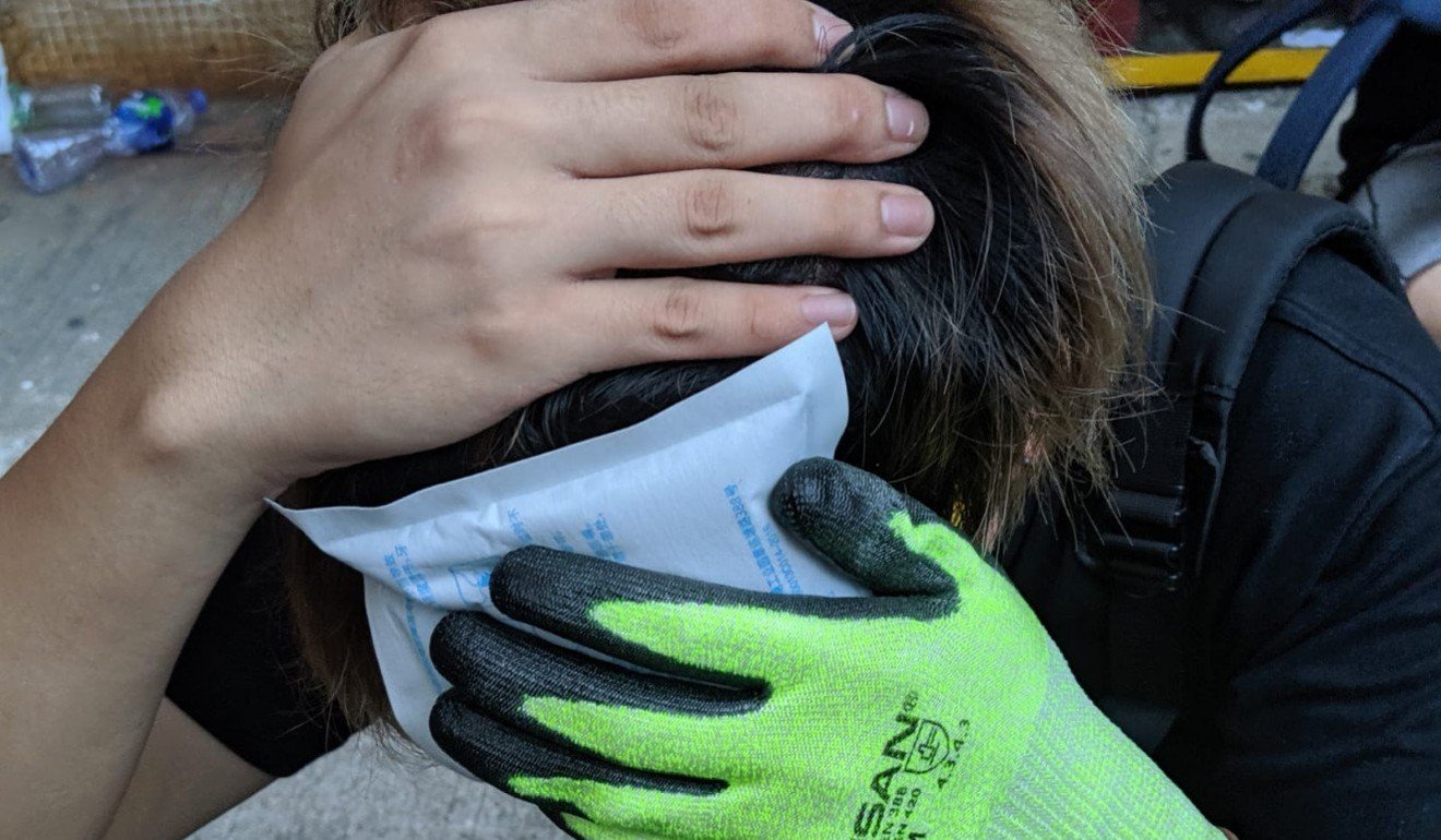 A protester covers his face after being struck by a round of tear gas on July 27. Photo: Handout