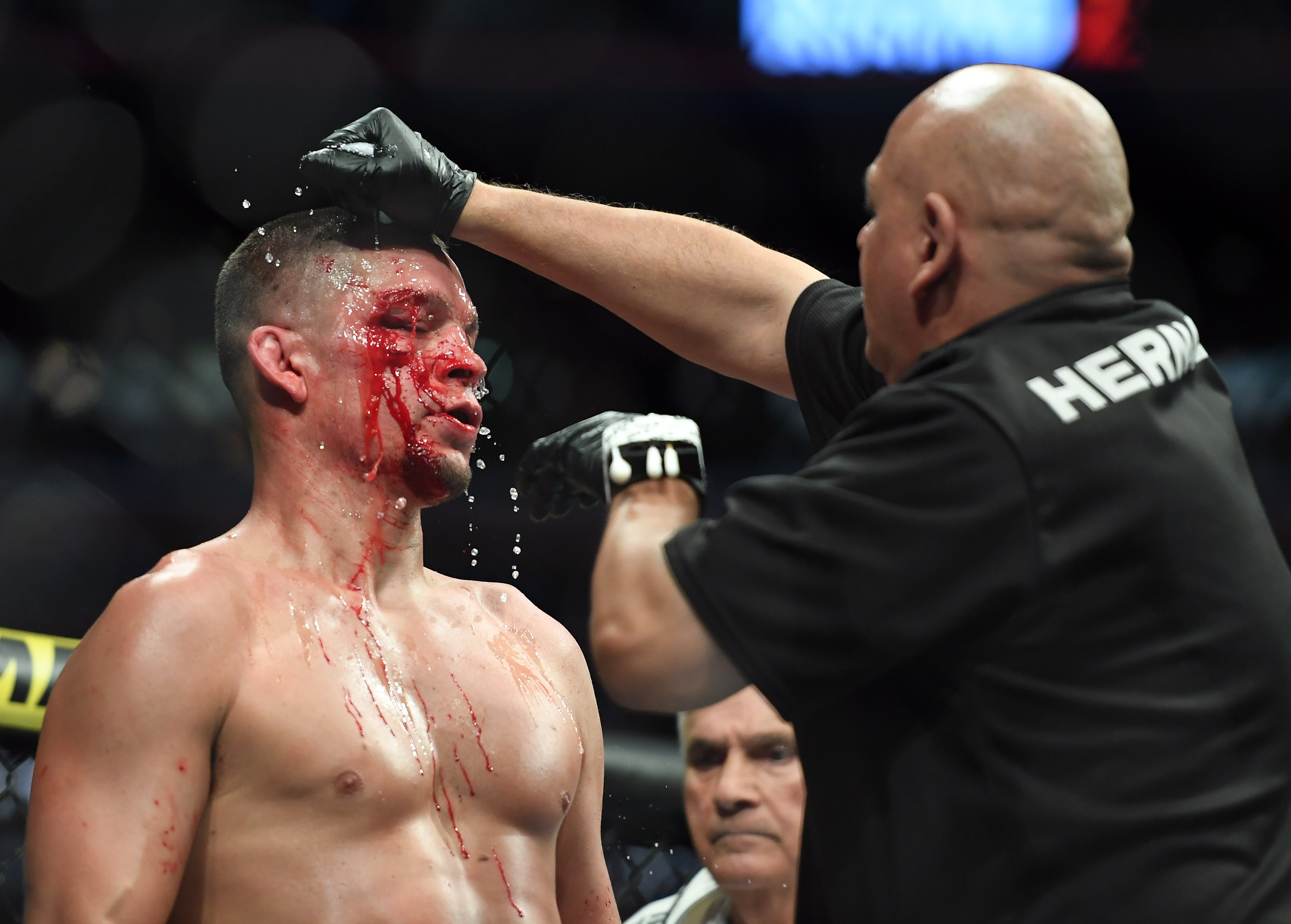 Nate Diaz gets treatment during his fight against Jorge Masvidal at UFC 244 at Madison Square Garden. Photo: USA TODAY Sports
