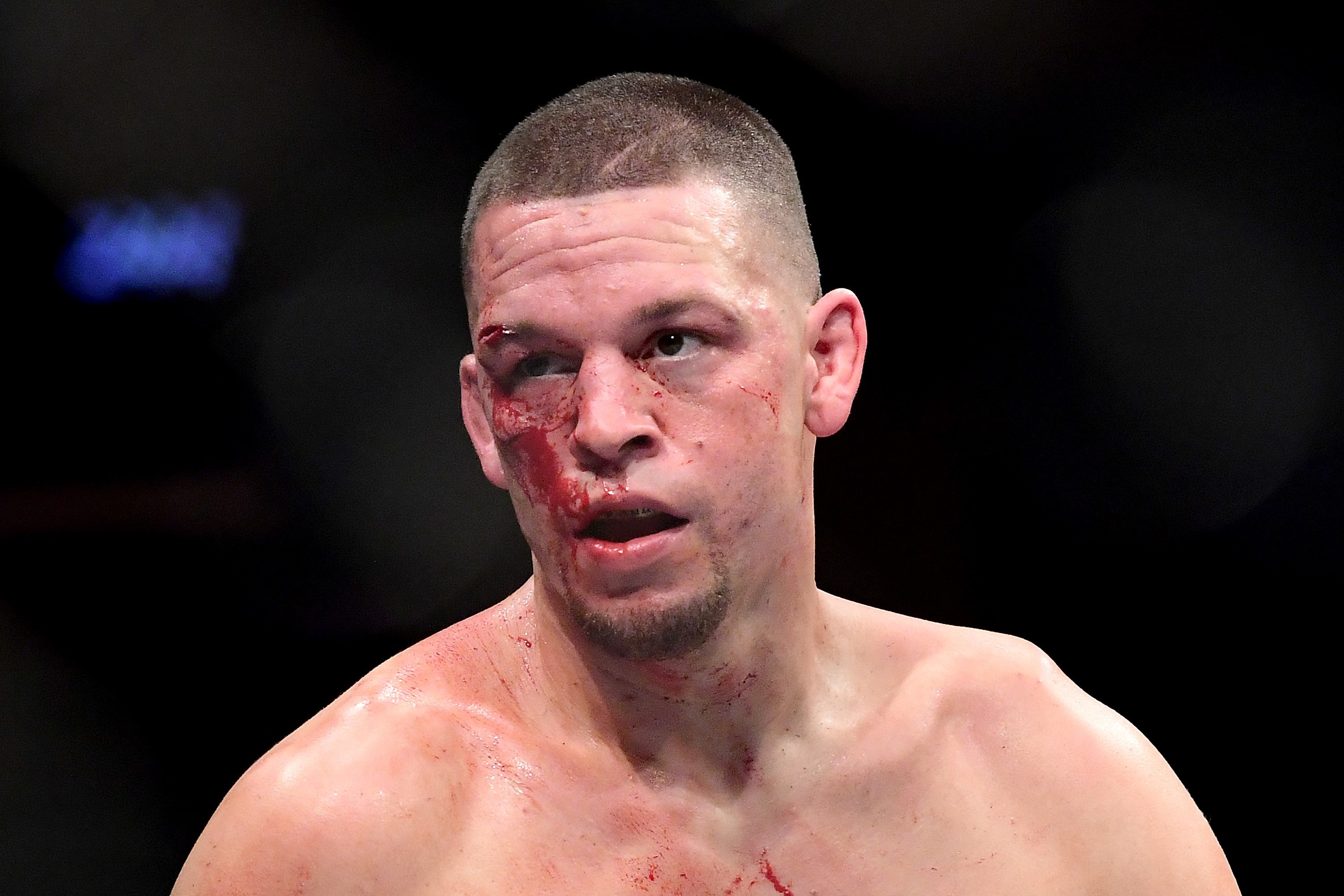 Nate Diaz wants to run it back with Jorge Masvidal after the doctor called their UFC 244 fight off. Photo: AFP