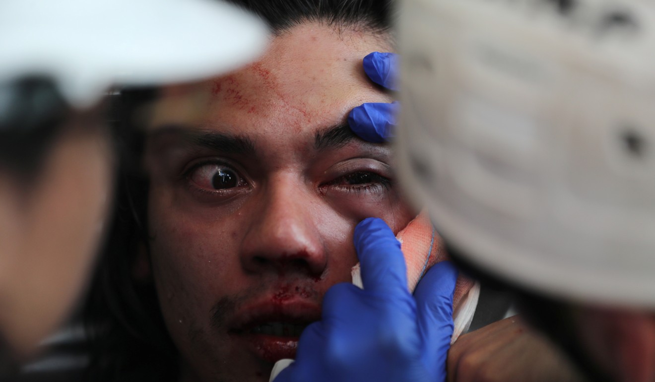 Felipe Berrios, who claims he was injured in his eye by a riot police officer, receives first aid during a protest in Santiago. Photo: Reuters