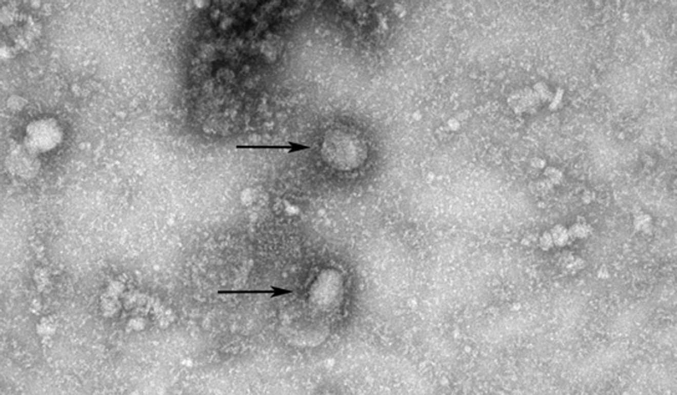 An image of the virus on the GISAID website after Chinese authorities provided information on its genetic sequence. Photo: GISAID