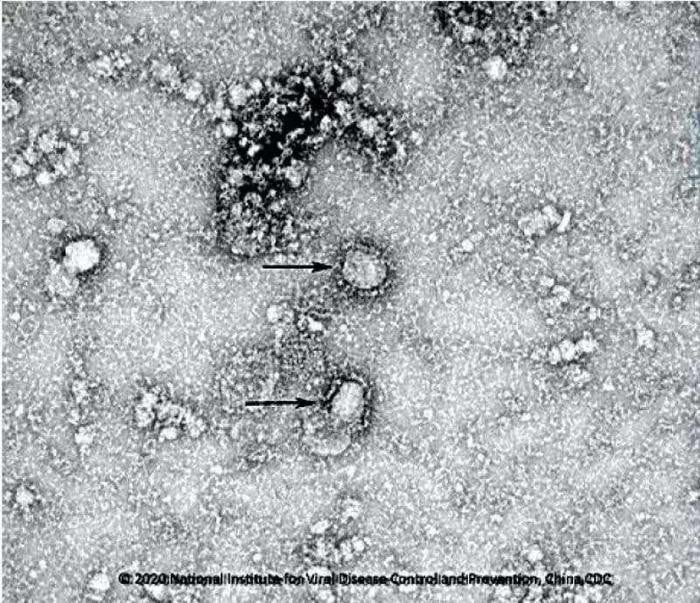 The first close-up images of the Wuhan coronavirus were released on Friday. Photo: Chinese Centre For Disease Control And Prevention